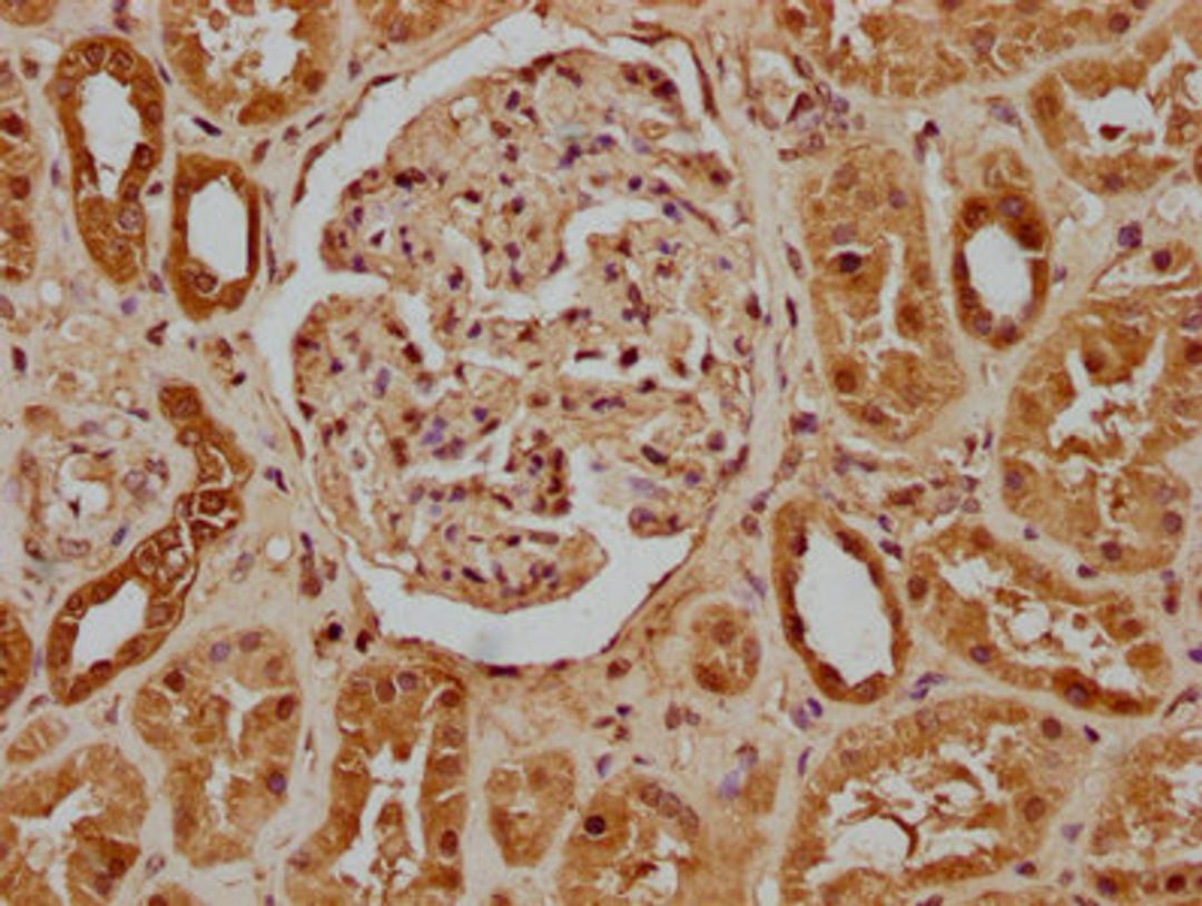 IHC image of CSB-PA896937LA01HU diluted at 1:100 and staining in paraffin-embedded human kidney tissue performed on a Leica BondTM system. After dewaxing and hydration, antigen retrieval was mediated by high pressure in a citrate buffer (pH 6.0). Section was blocked with 10% normal goat serum 30min at RT. Then primary antibody (1% BSA) was incubated at 4°C overnight. The primary is detected by a biotinylated secondary antibody and visualized using an HRP conjugated SP system.