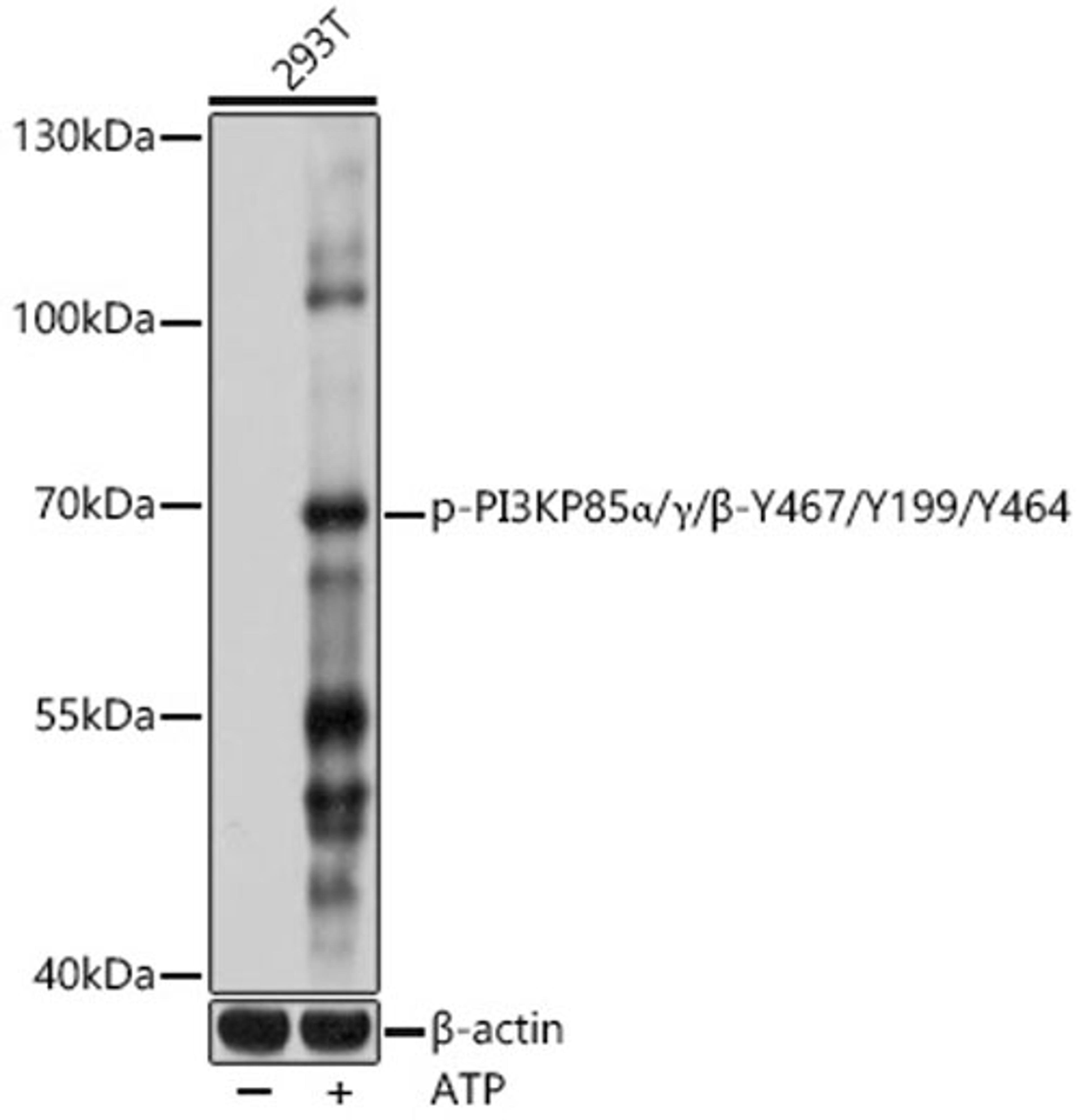 Western blot - Phospho-PI3KP85a/?/ß-Y467/Y199/Y464 antibody (AP0854)