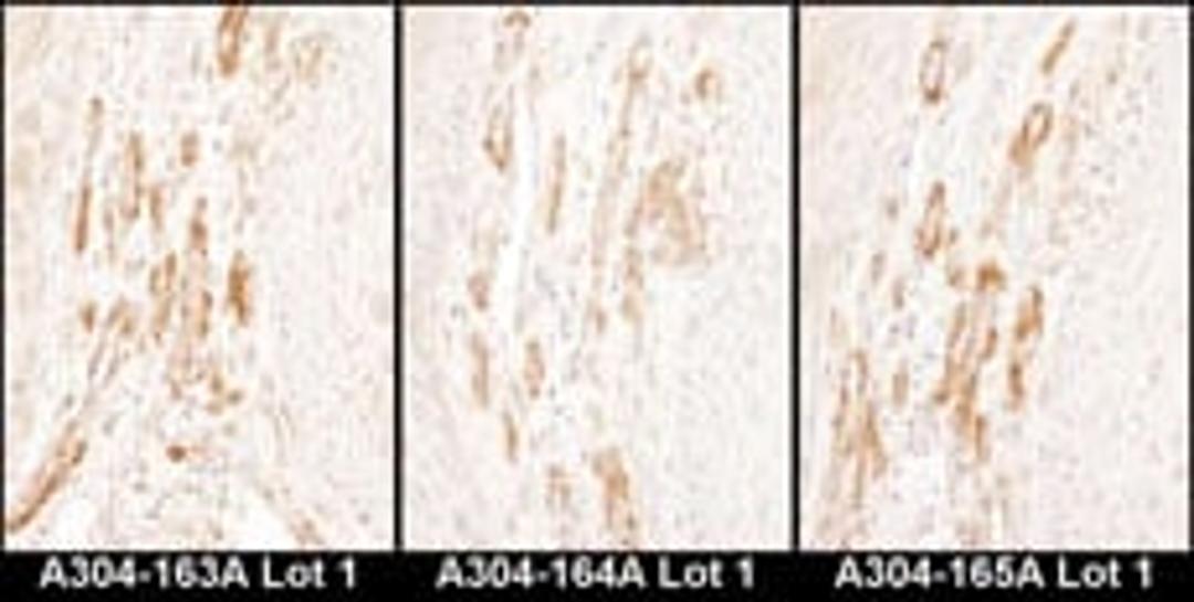 Detection of human Caldesmon by immunohistochemistry.