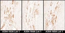 Detection of human Caldesmon by immunohistochemistry.