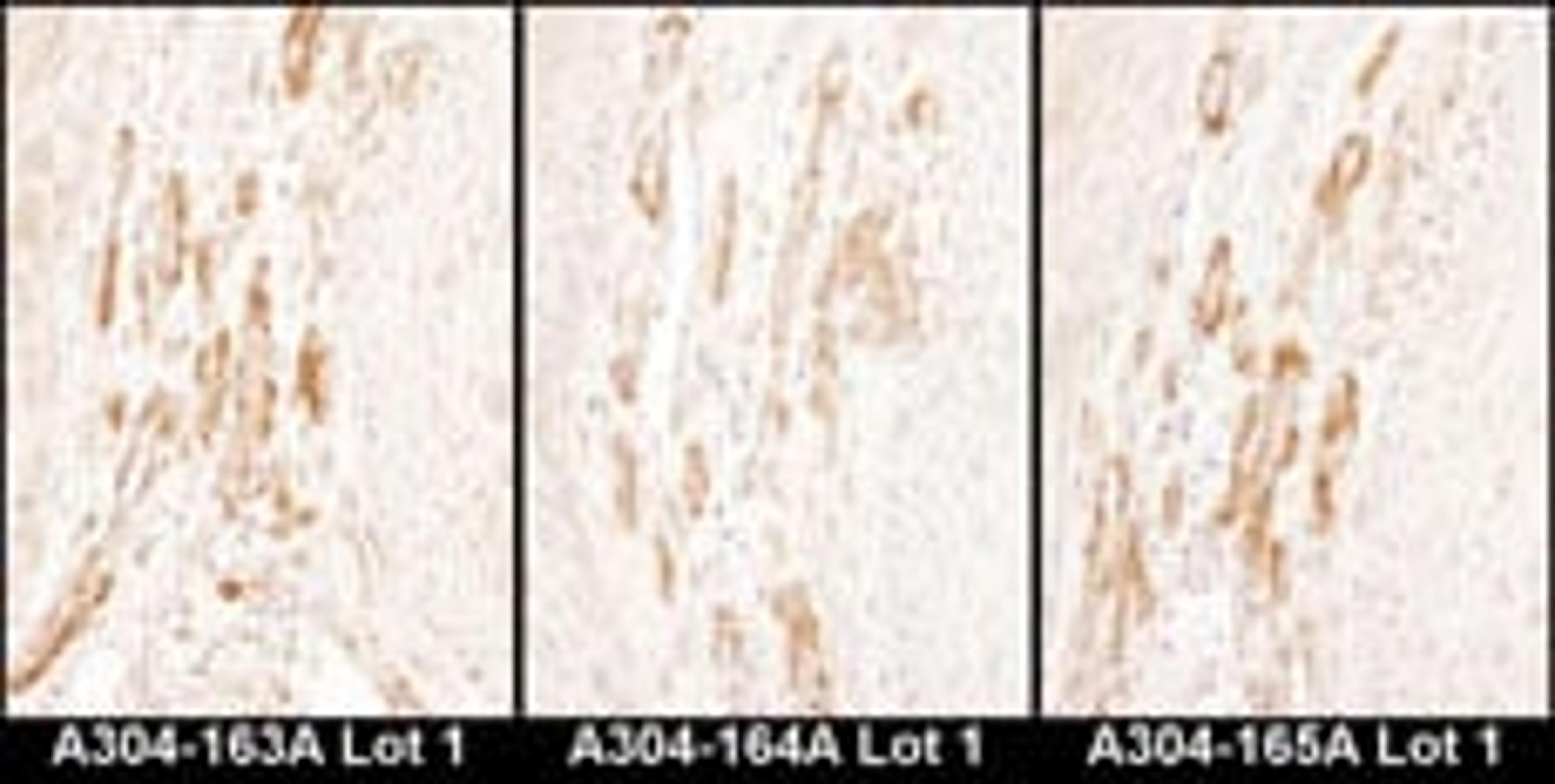 Detection of human Caldesmon by immunohistochemistry.