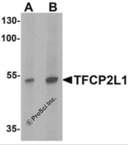 Western blot analysis of TFCP2L1 in human colon tissue lysate with TFCP2L1 antibody at (A) 1 and (B) 2 &#956;g/mL