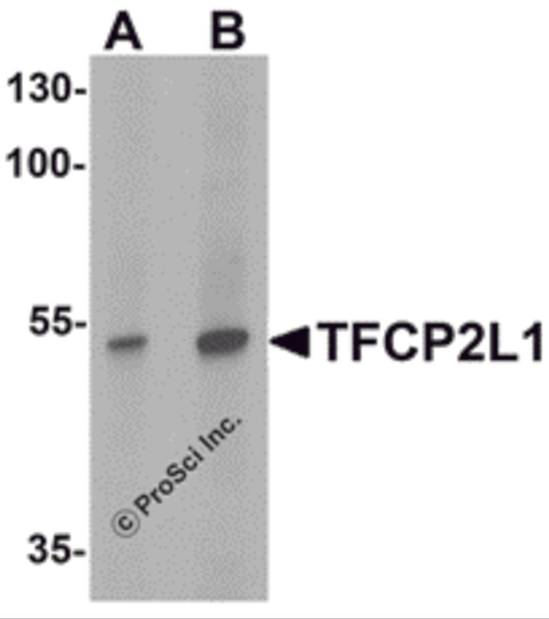 Western blot analysis of TFCP2L1 in human colon tissue lysate with TFCP2L1 antibody at (A) 1 and (B) 2 μg/mL