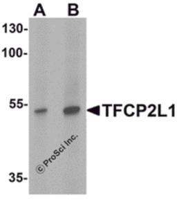 Western blot analysis of TFCP2L1 in human colon tissue lysate with TFCP2L1 antibody at (A) 1 and (B) 2 μg/mL