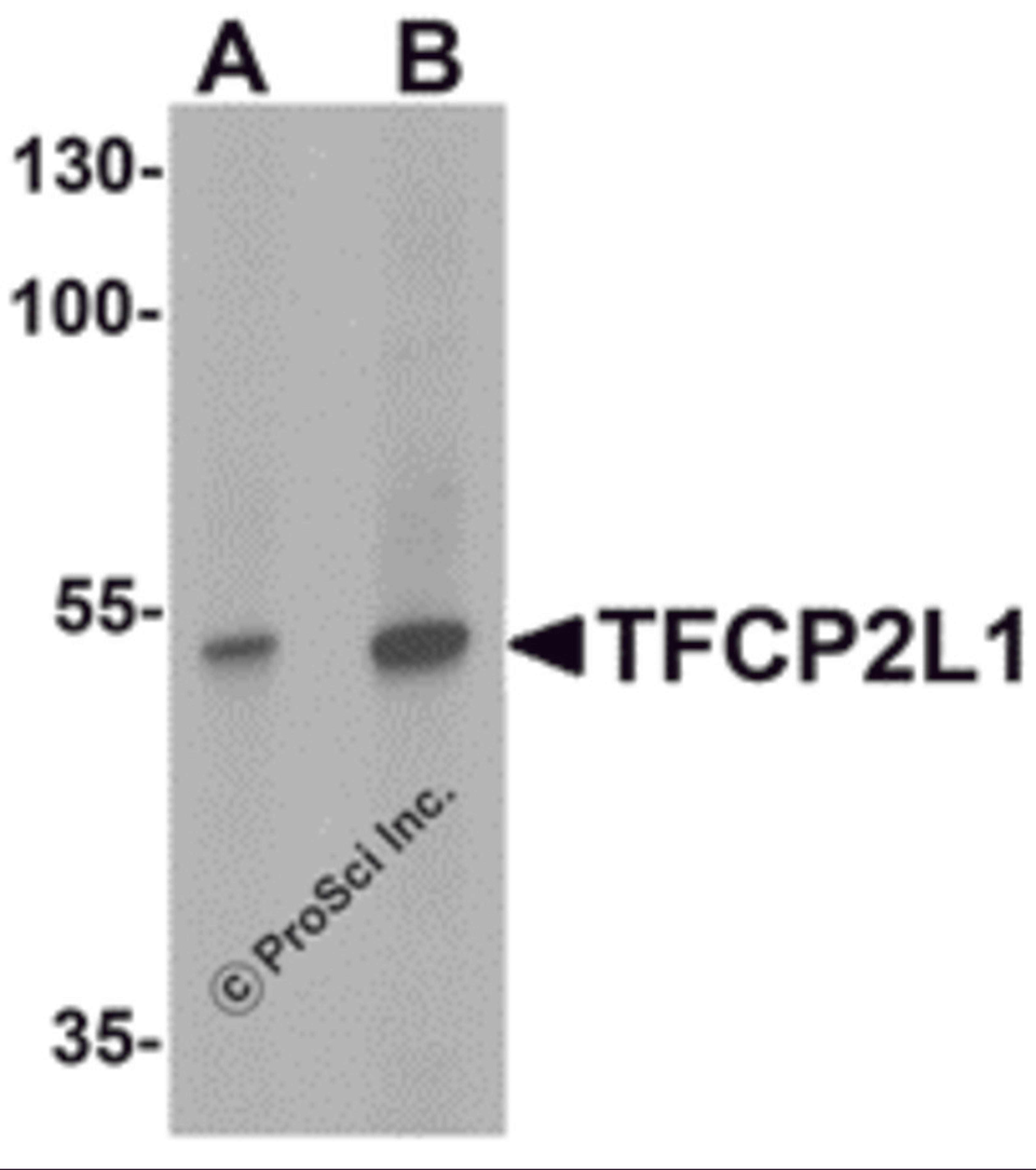 Western blot analysis of TFCP2L1 in human colon tissue lysate with TFCP2L1 antibody at (A) 1 and (B) 2 μg/mL