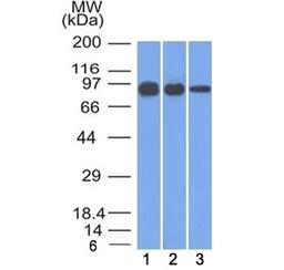 Western blot testing of human 1) A431, 2) A549 and 3) MCF7 cell lysate with Beta Catenin antibody (clone 12F7). Expected molecular weight ~92 kDa.