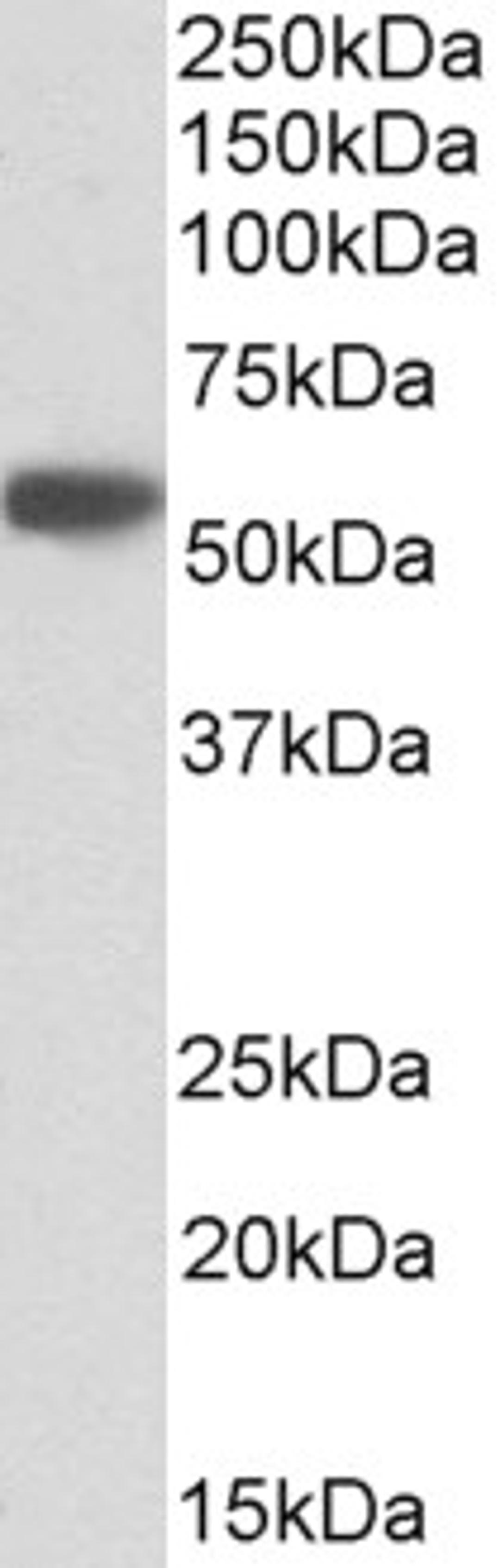 43-457 (0.1ug/ml) staining of Albumin-depleted Human Serum lysate (35ug protein in RIPA buffer). Primary incubation was 1 hour. Detected by chemiluminescence.