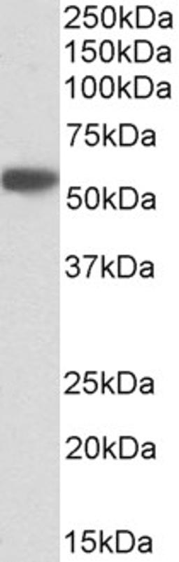 43-457 (0.1ug/ml) staining of Albumin-depleted Human Serum lysate (35ug protein in RIPA buffer). Primary incubation was 1 hour. Detected by chemiluminescence.