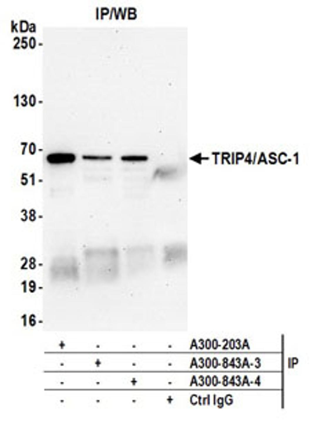 Detection of human TRIP4/ASC-1 by western blot of immunoprecipitates.