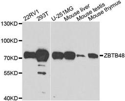 Western blot analysis of extracts of various cell lines using ZBTB48 antibody