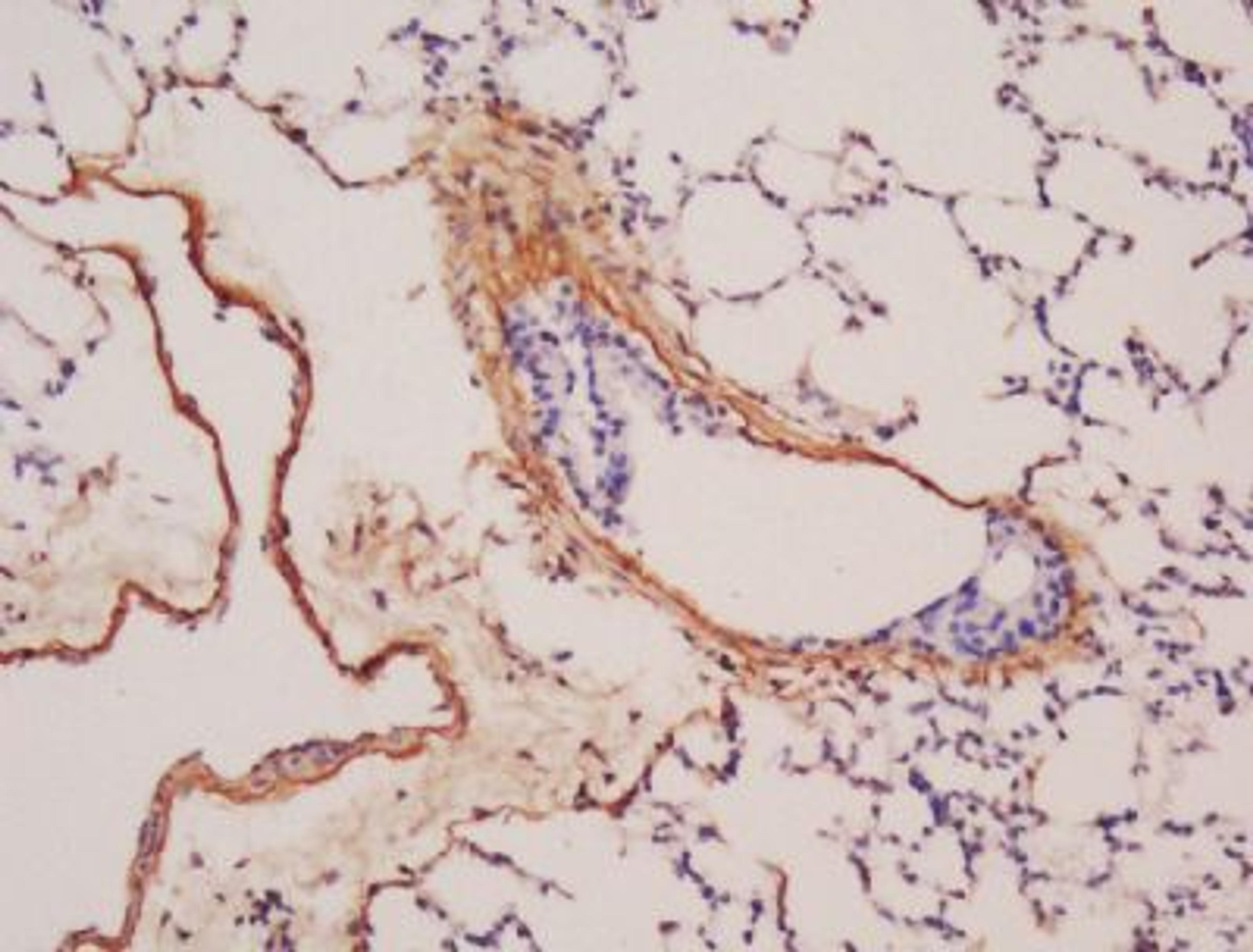 Immunohistochemical analysis of formalin-fixed paraffin embedded mouse lung tissue using BMP6 antibody (dilution at 1:200)