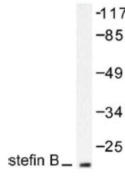 Western Blot: Stefin B Antibody [NB100-91979] - Western blot (WB) analysis of Stefin B (N84) antibody  in extracts from A549 cells