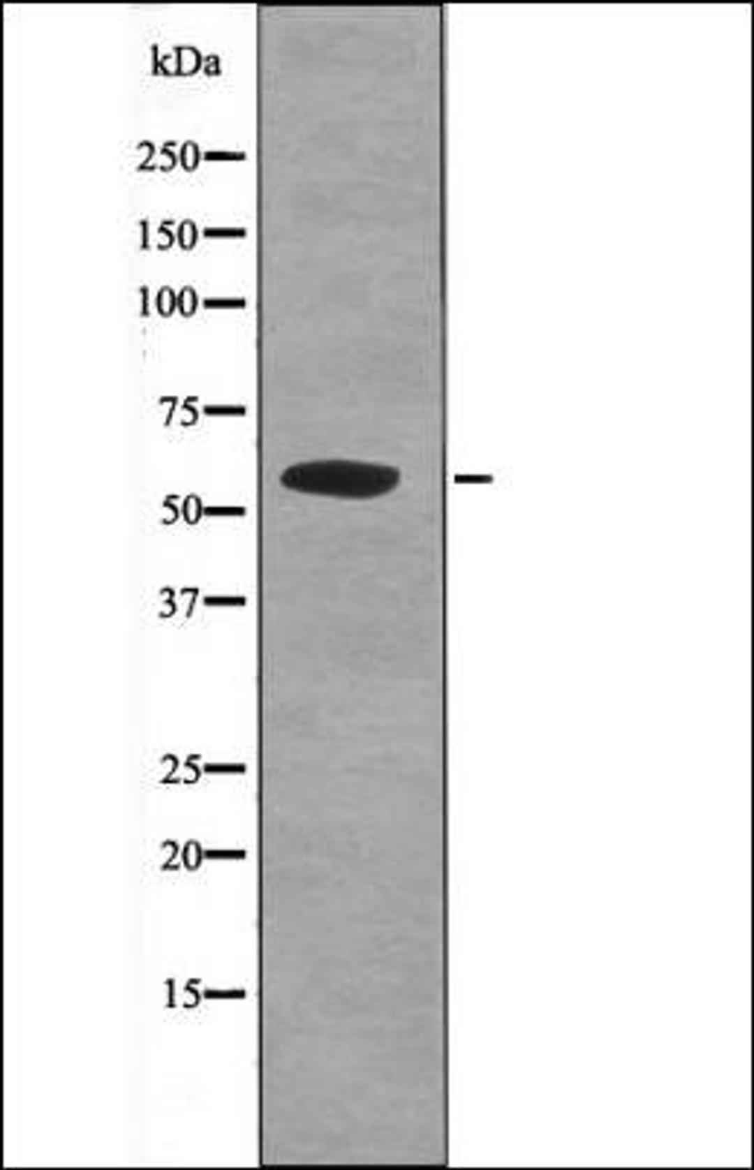 Western blot analysis of Starvation treated K562 whole cell lysates using APLF -Phospho-Ser116- antibody