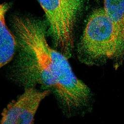 Immunocytochemistry/Immunofluorescence: PTK9 Antibody [NBP1-90297] - Staining of human cell line U-251MG shows positivity in cytoplasm.