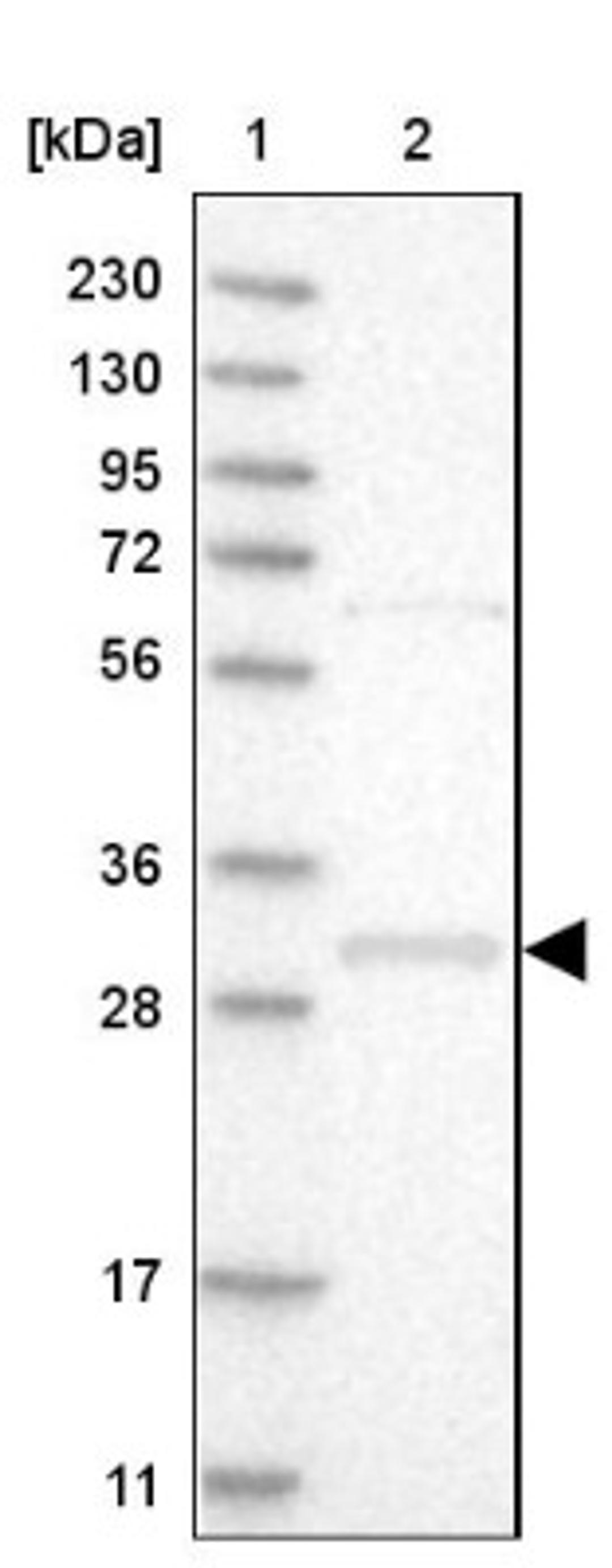 Western Blot: WBSCR27 Antibody [NBP1-86008] - Lane 1: Marker [kDa] 230, 130, 95, 72, 56, 36, 28, 17, 11<br/>Lane 2: Human cell line RT-4