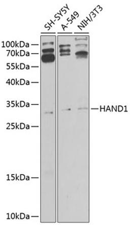 Western blot - HAND1 antibody (A9855)