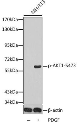 Western blot - Phospho-AKT1-S473 antibody (AP0140)