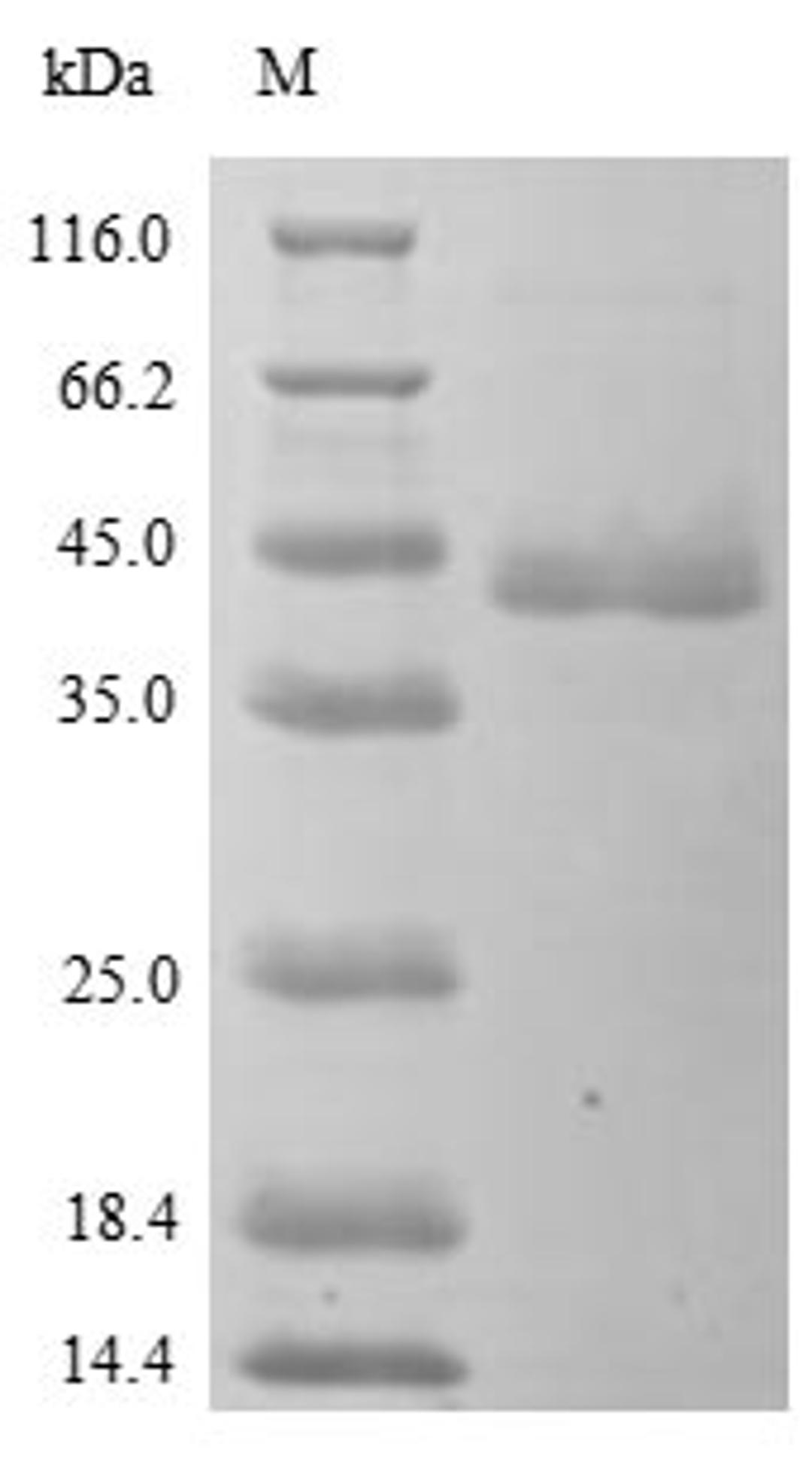 (Tris-Glycine gel) Discontinuous SDS-PAGE (reduced) with 5% enrichment gel and 15% separation gel.