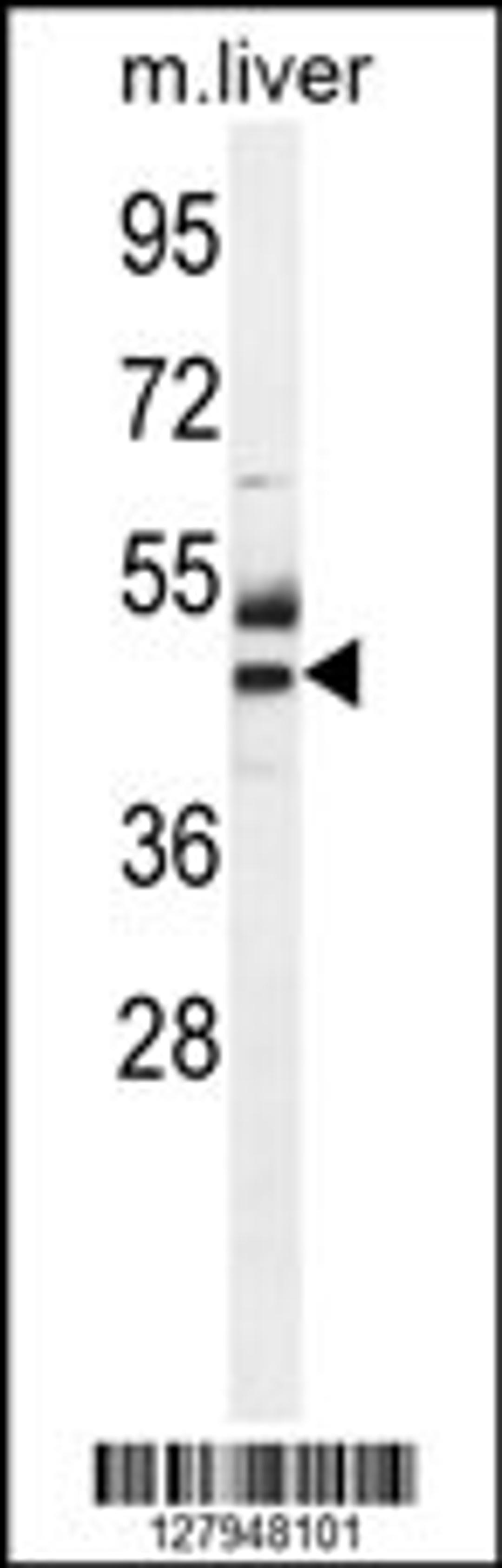 Western blot analysis in mouse liver tissue lysates (35ug/lane).