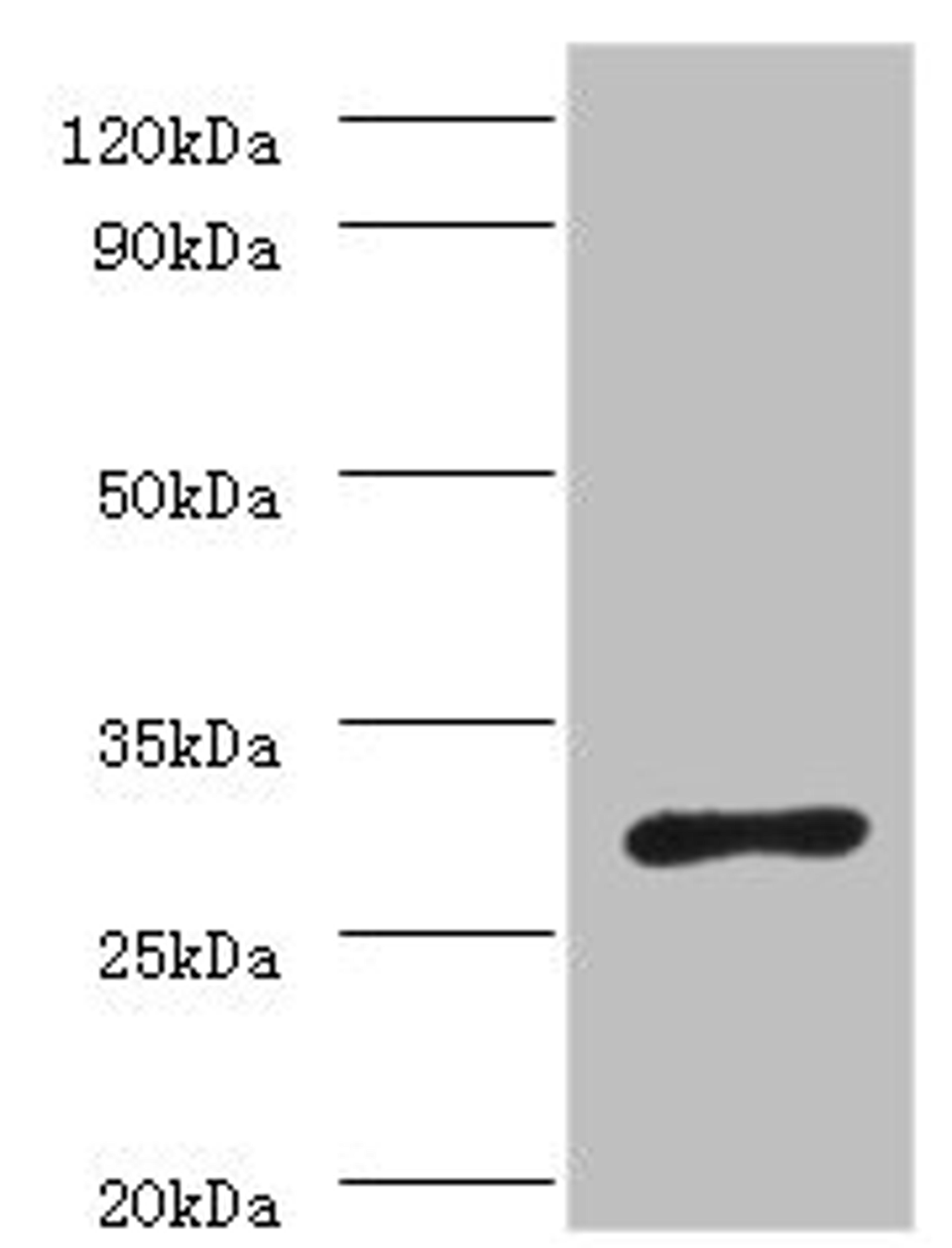 Western blot. All lanes: ureA antibody at 2µg/ml + Helicobacter pylori bacteria liquid. Secondary. Goat polyclonal to rabbit IgG at 1/10000 dilution. Predicted band size: 27 kDa. Observed band size: 27 kDa
