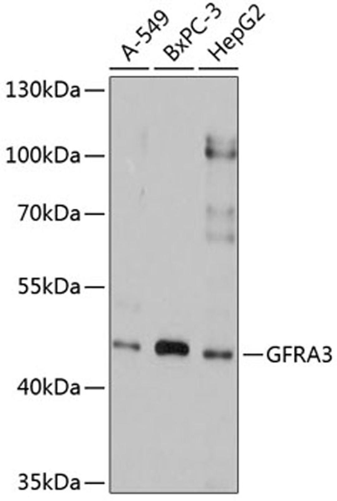 Western blot - GFRA3 antibody (A2955)