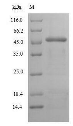 (Tris-Glycine gel) Discontinuous SDS-PAGE (reduced) with 5% enrichment gel and 15% separation gel.