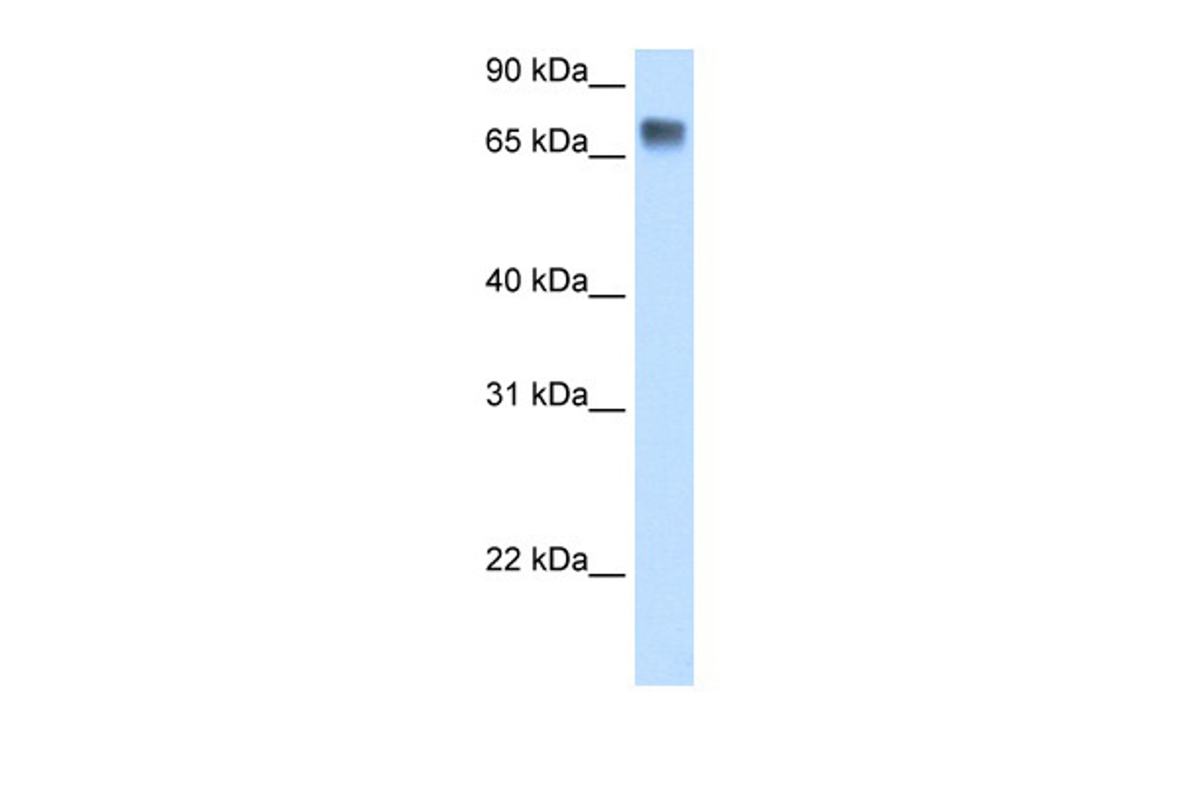 Antibody used in WB on Human Liver at 0.2-1 ug/ml.