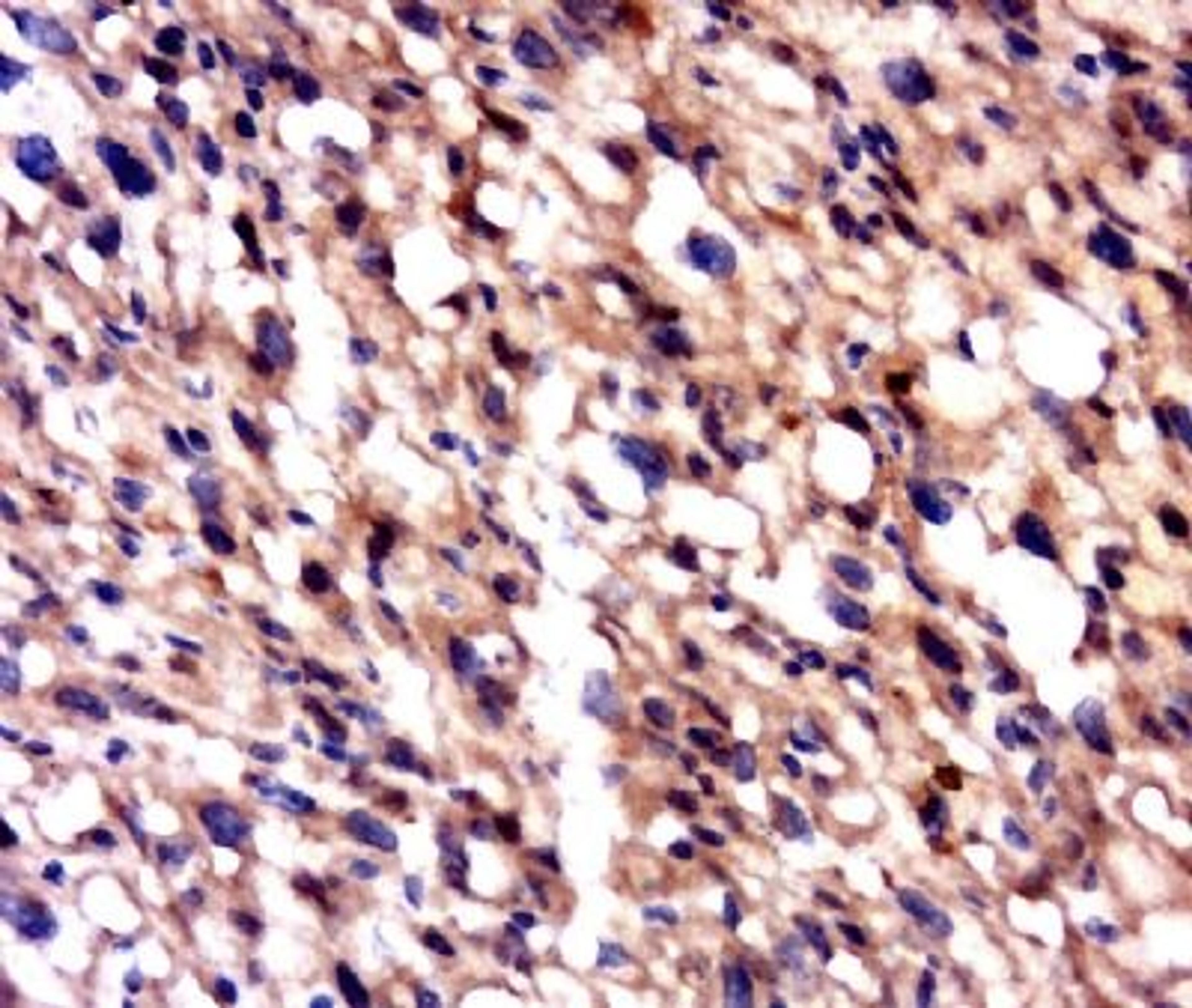 Immunohistochemical staining of Mouse Placenta Lysate using PLEKHM1 antibody.