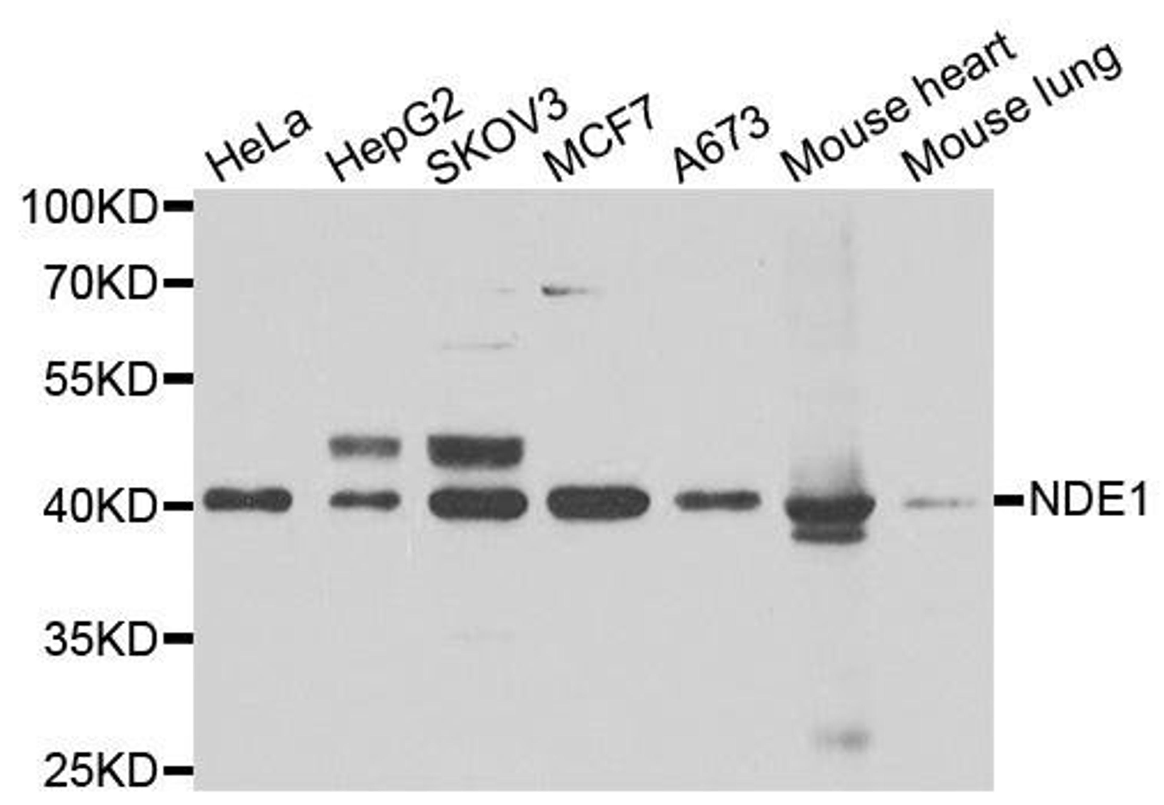 Western blot analysis of extracts of various cell lines using NDE1 antibody