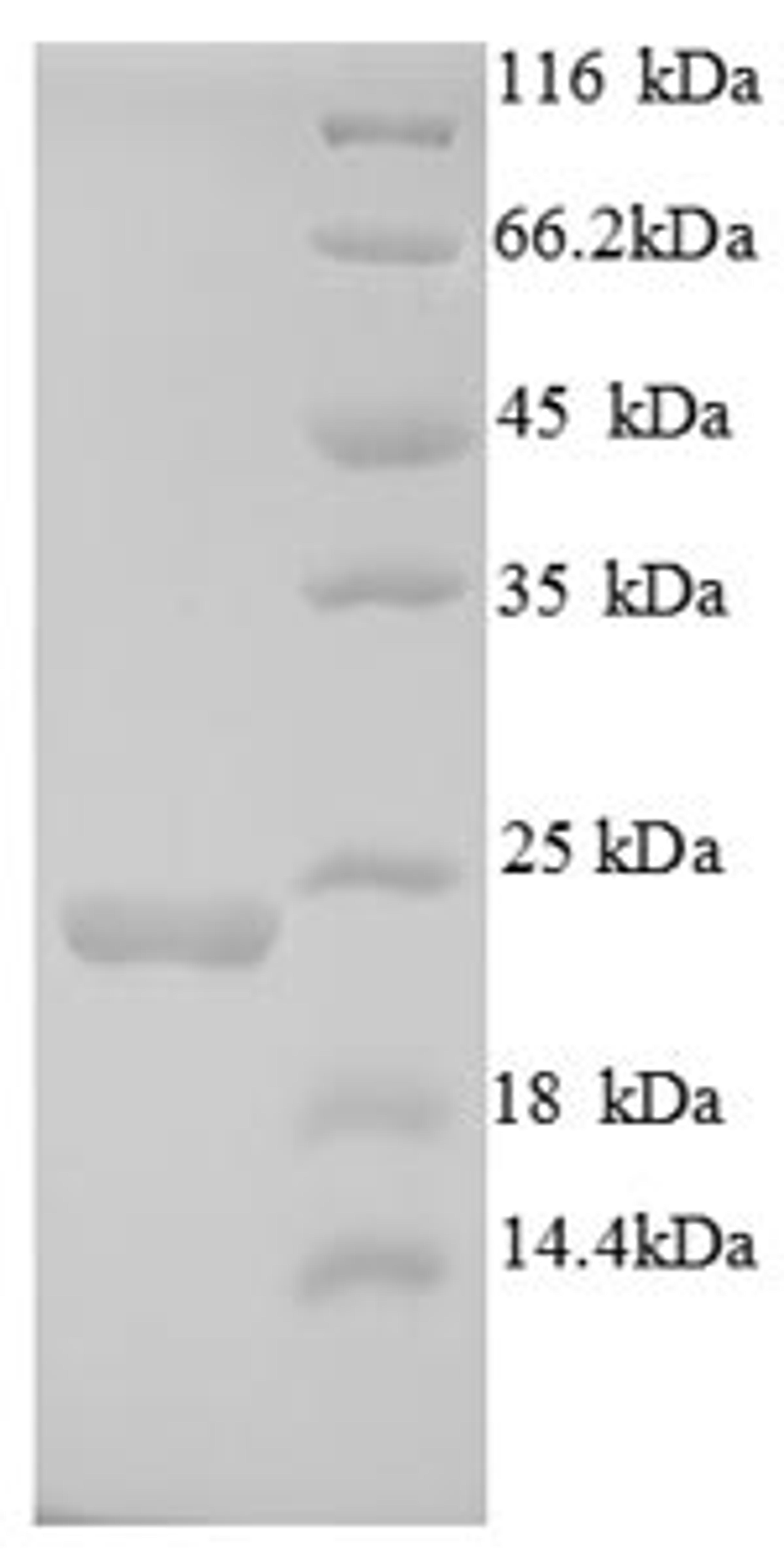 (Tris-Glycine gel) Discontinuous SDS-PAGE (reduced) with 5% enrichment gel and 15% separation gel.