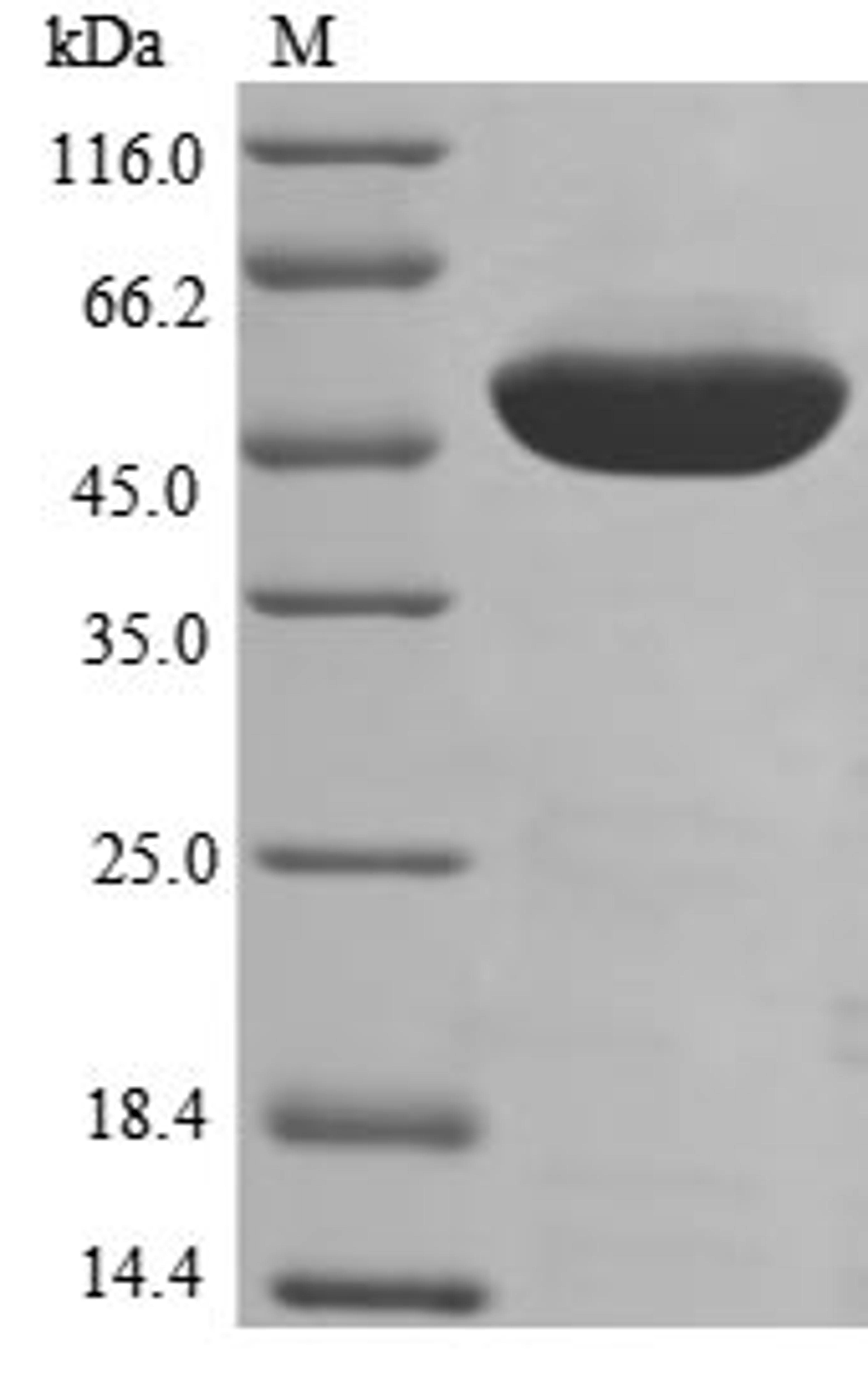 (Tris-Glycine gel) Discontinuous SDS-PAGE (reduced) with 5% enrichment gel and 15% separation gel.