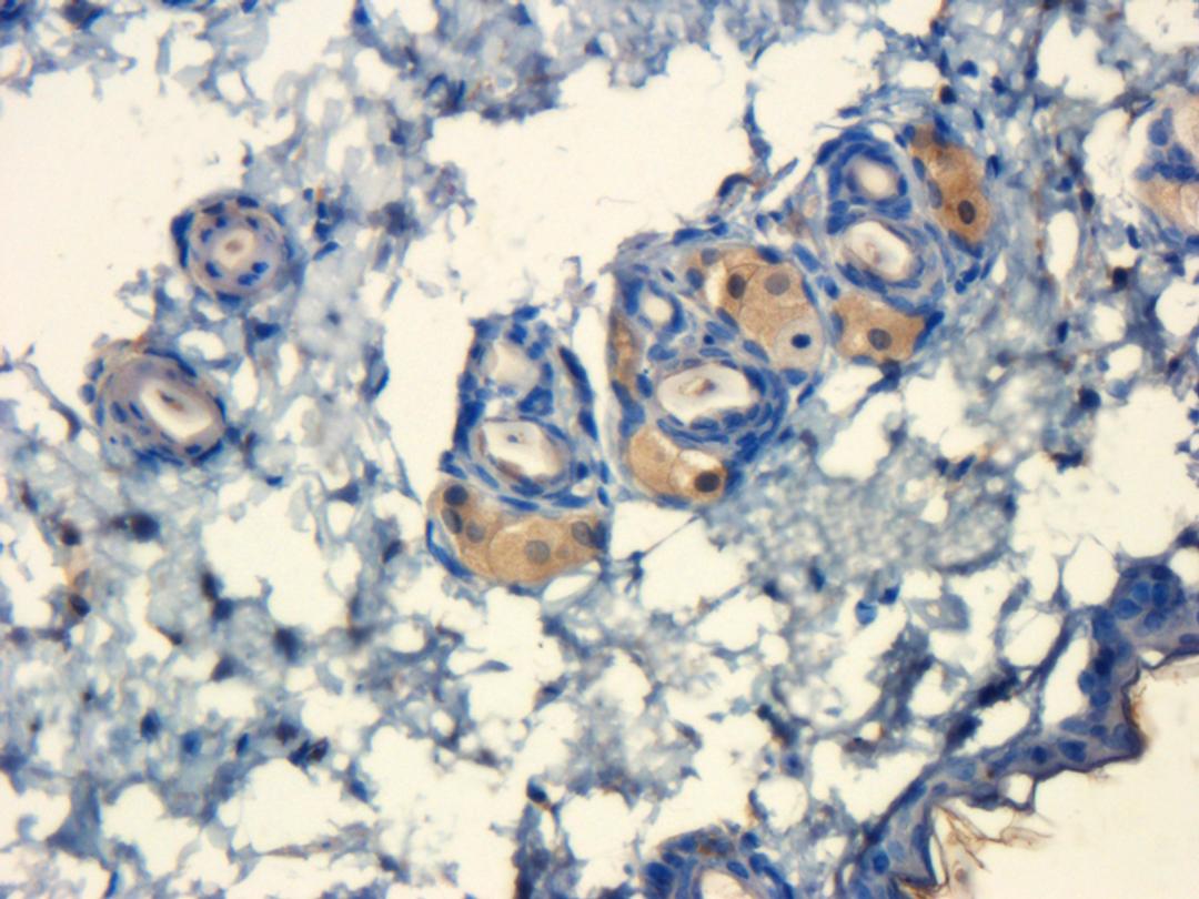 Immunohistochemical staining of mouse skin tissue using IL10 antibody (dilution of primary antibody - 1:100)