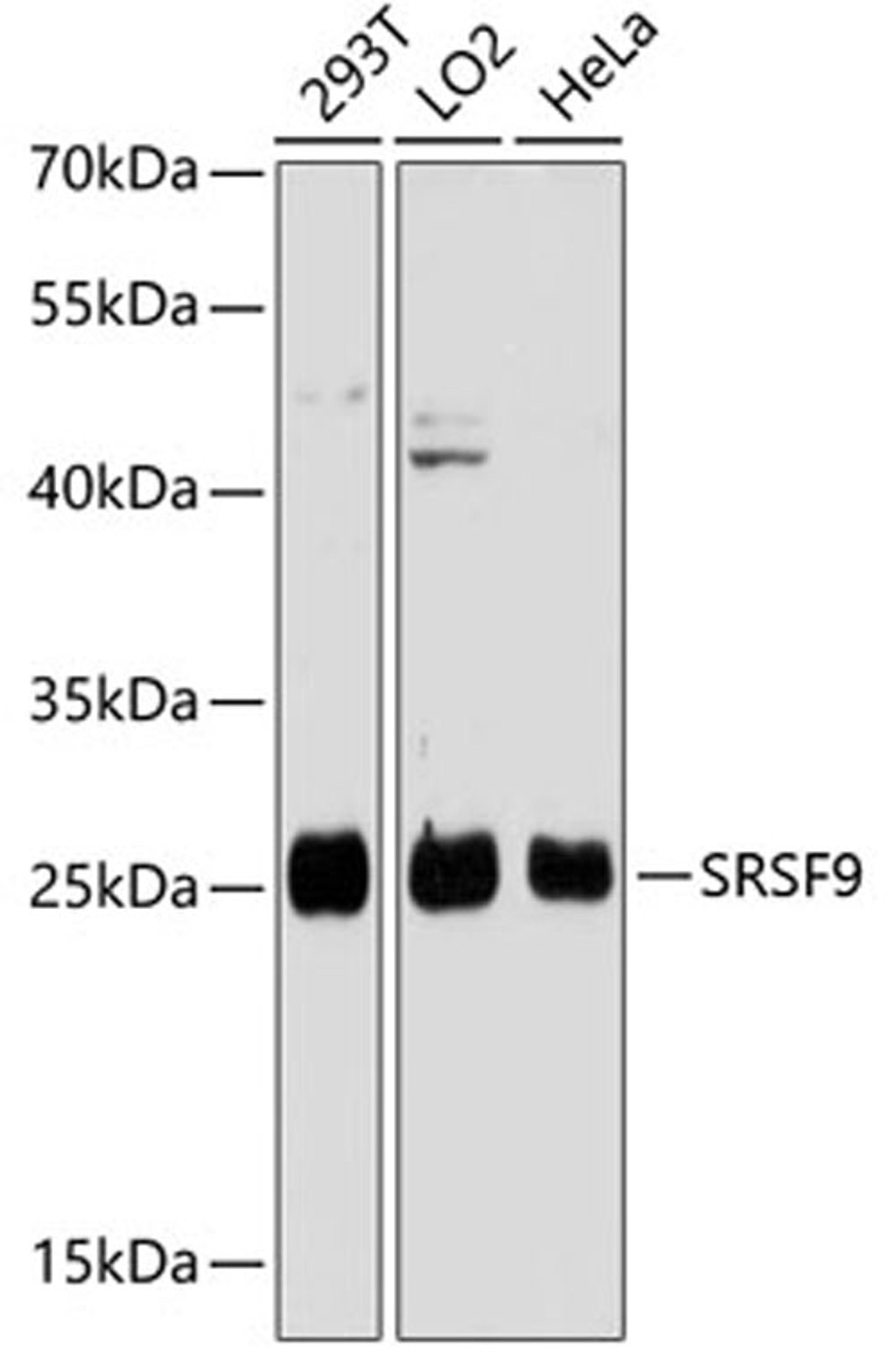 Western blot - SRSF9 antibody (A13265)