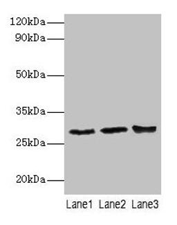 Western blot. All lanes: Ca1 antibody at 2µg/ml. Lane 1: Rat spleen tissue. Lane 2: Rat lung tissue. Lane 3: Rat kidney tissue. Secondary. Goat polyclonal to rabbit IgG at 1/10000 dilution. Predicted band size: 29 kDa. Observed band size: 29 kDa