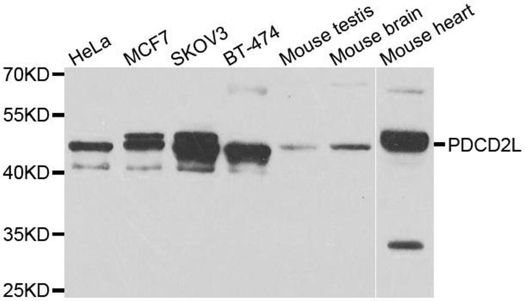 Western blot analysis of extracts of various cell lines using PDCD2L antibody