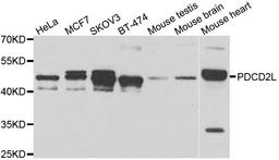 Western blot analysis of extracts of various cell lines using PDCD2L antibody