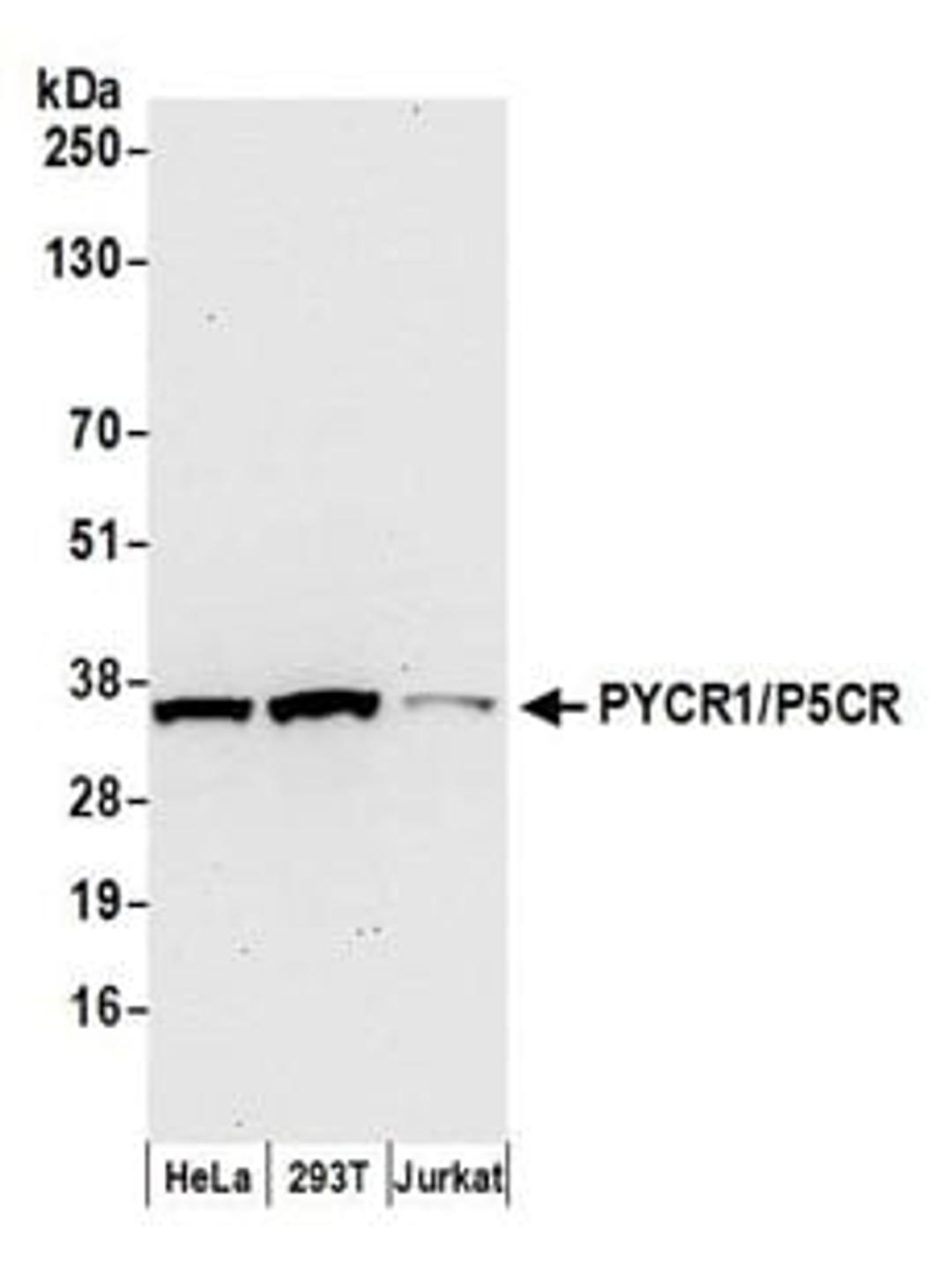 Detection of human PYCR1/P5CR by western blot.