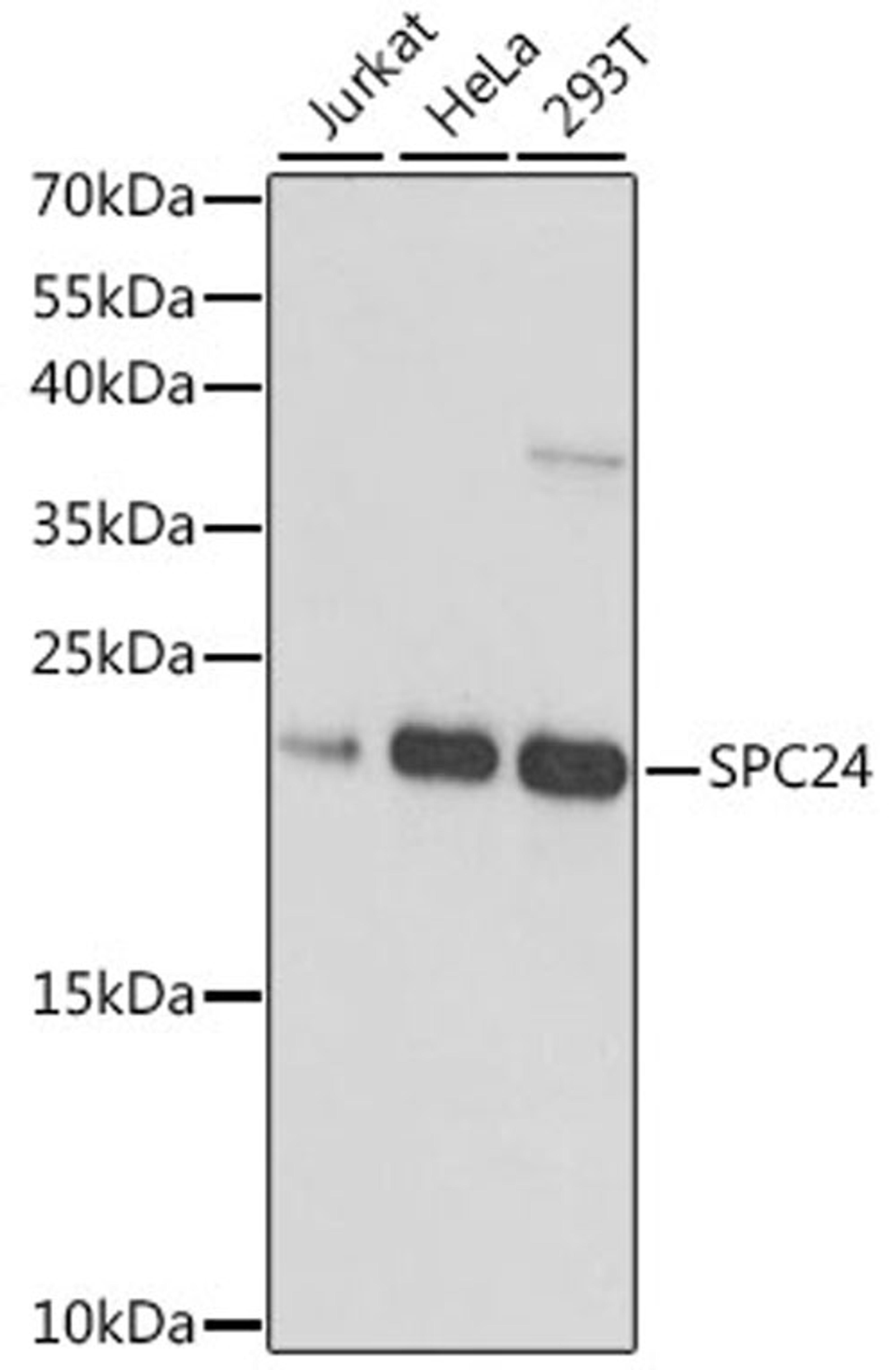 Western blot - SPC24 antibody (A16601)