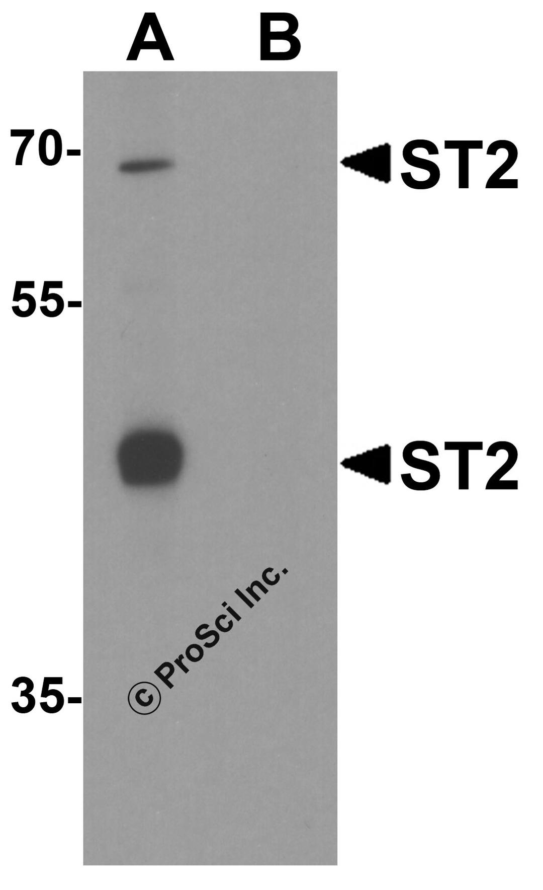 Western blot analysis of ST2 in 293 cell lysate with ST2 antibody at 1 μg/ml in (A) the absence and (B) the presence of blocking peptide.