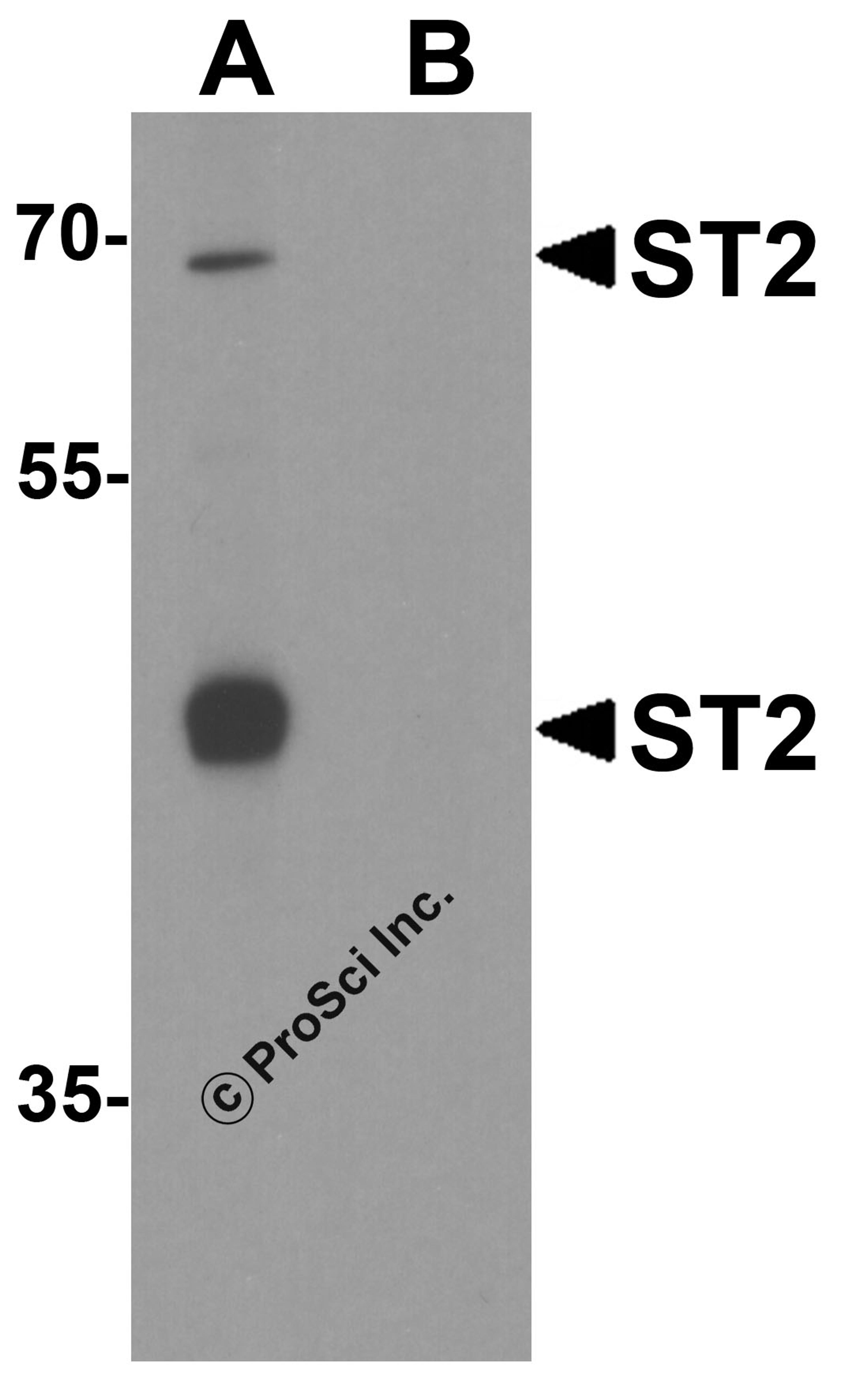 Western blot analysis of ST2 in 293 cell lysate with ST2 antibody at 1 μg/ml in (A) the absence and (B) the presence of blocking peptide.