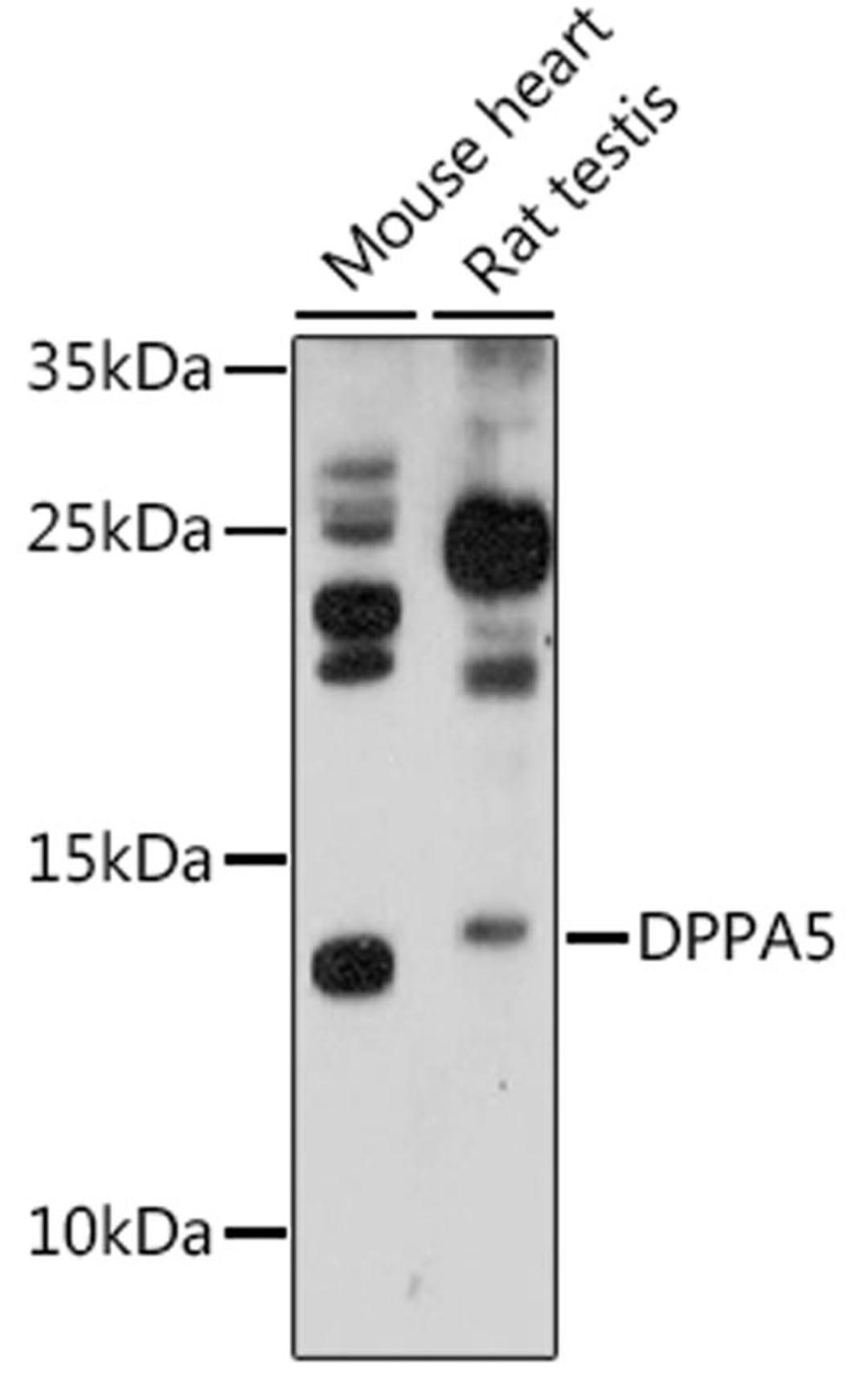 Western blot - DPPA5 antibody (A16280)