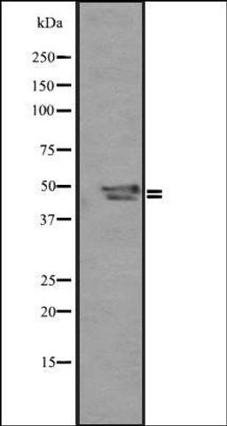 Western blot analysis of Mouse liver ti 721_B whole cell lysate using SP5/8/9 antibody