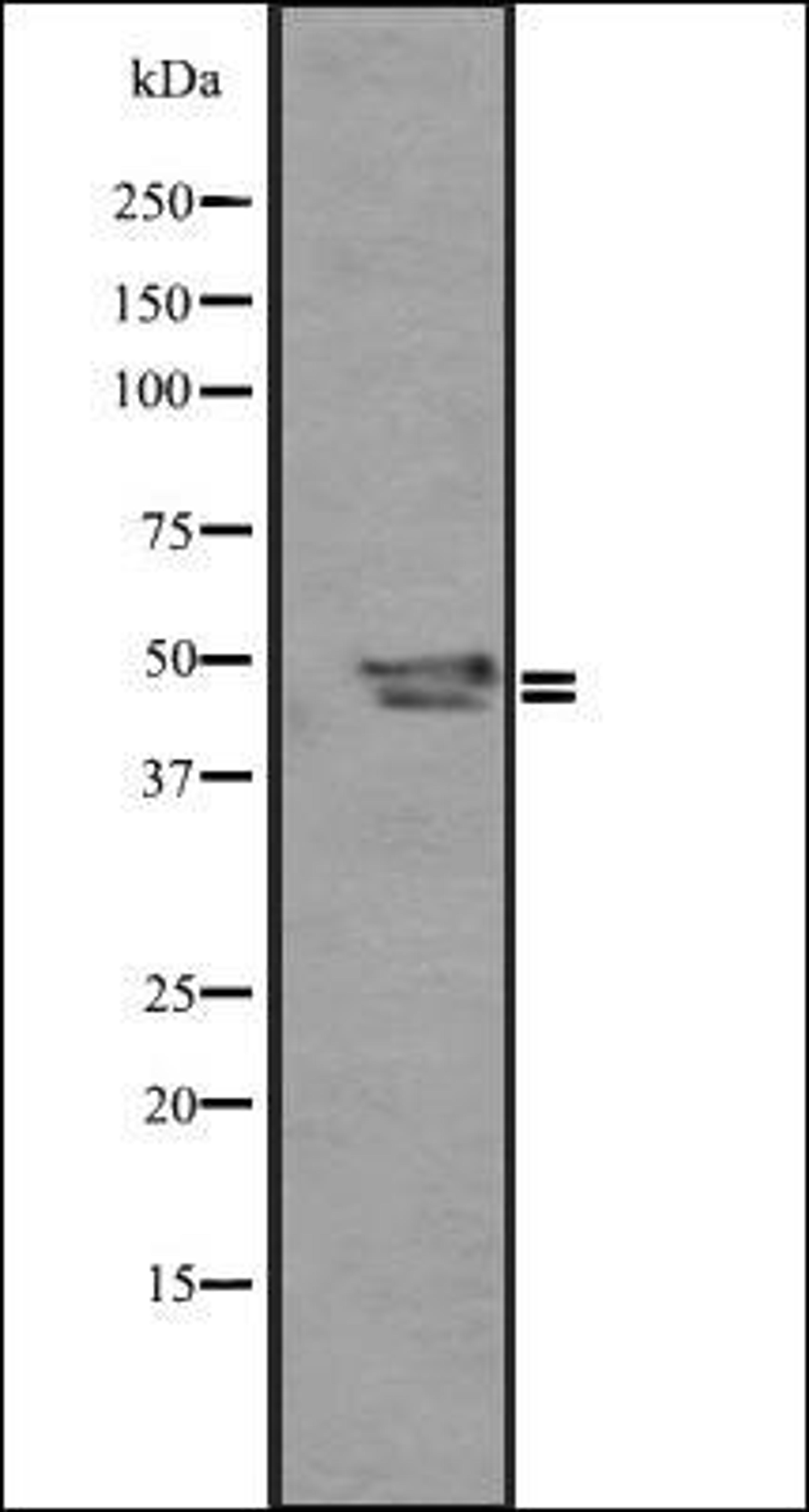 Western blot analysis of Mouse liver ti 721_B whole cell lysate using SP5/8/9 antibody