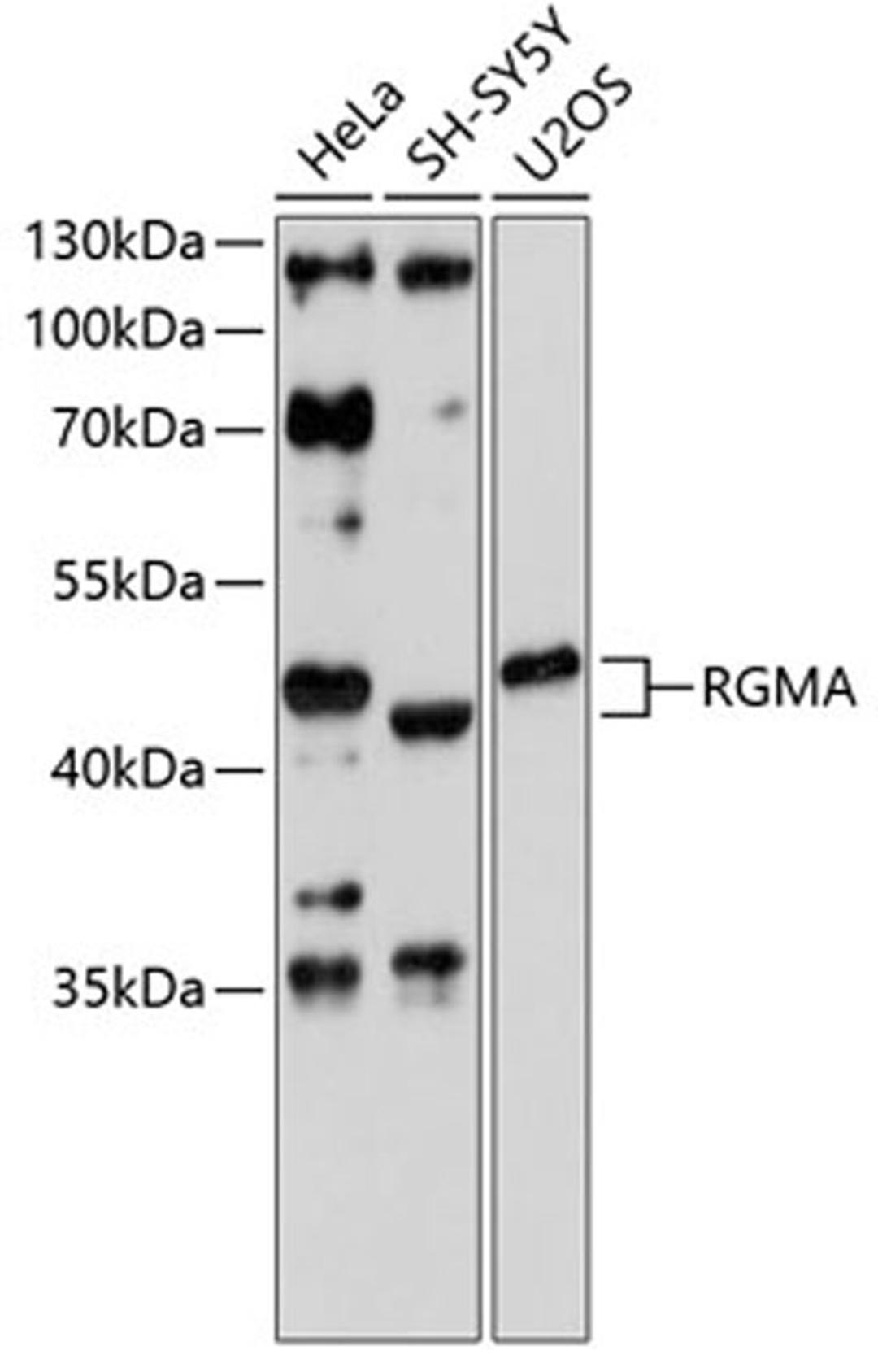 Western blot - RGMA antibody (A4878)