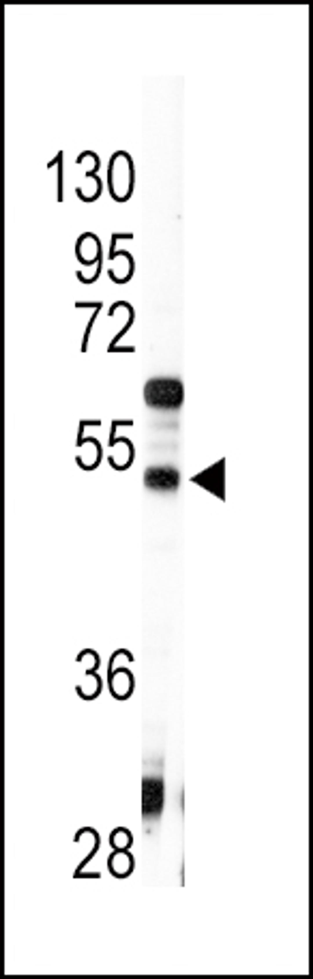 Western blot analysis of anti-AGT Antibody in HepG2 cell line lysates (35ug/lane)