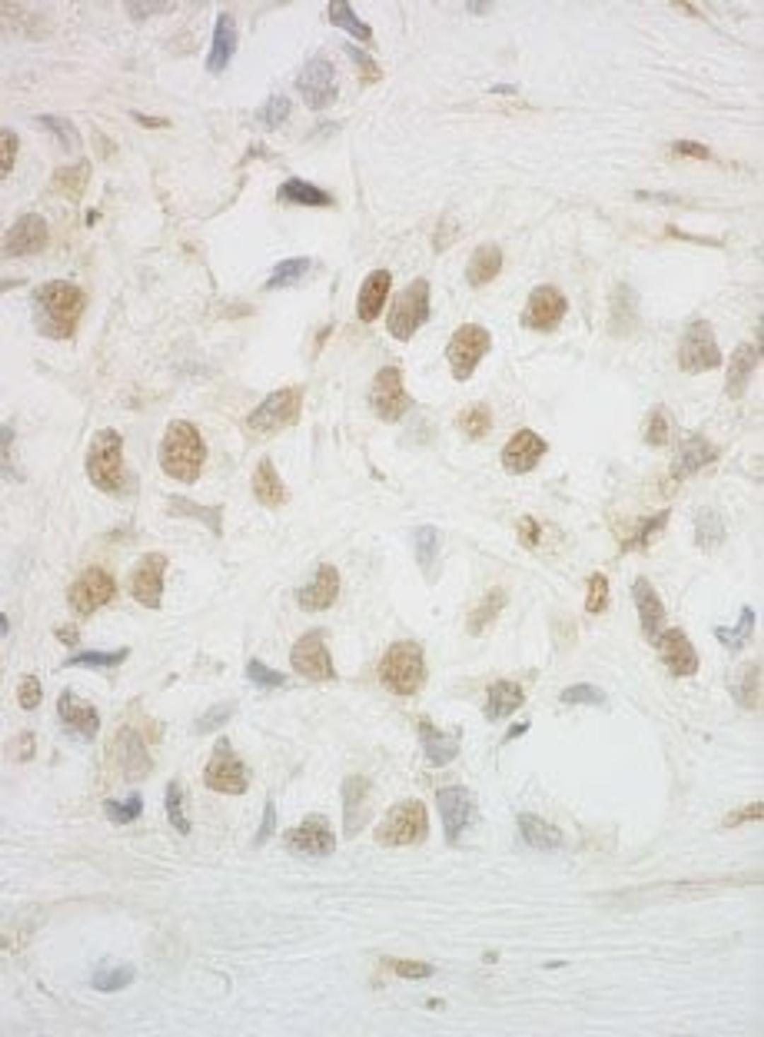 Detection of human HCA66 by immunohistochemistry.