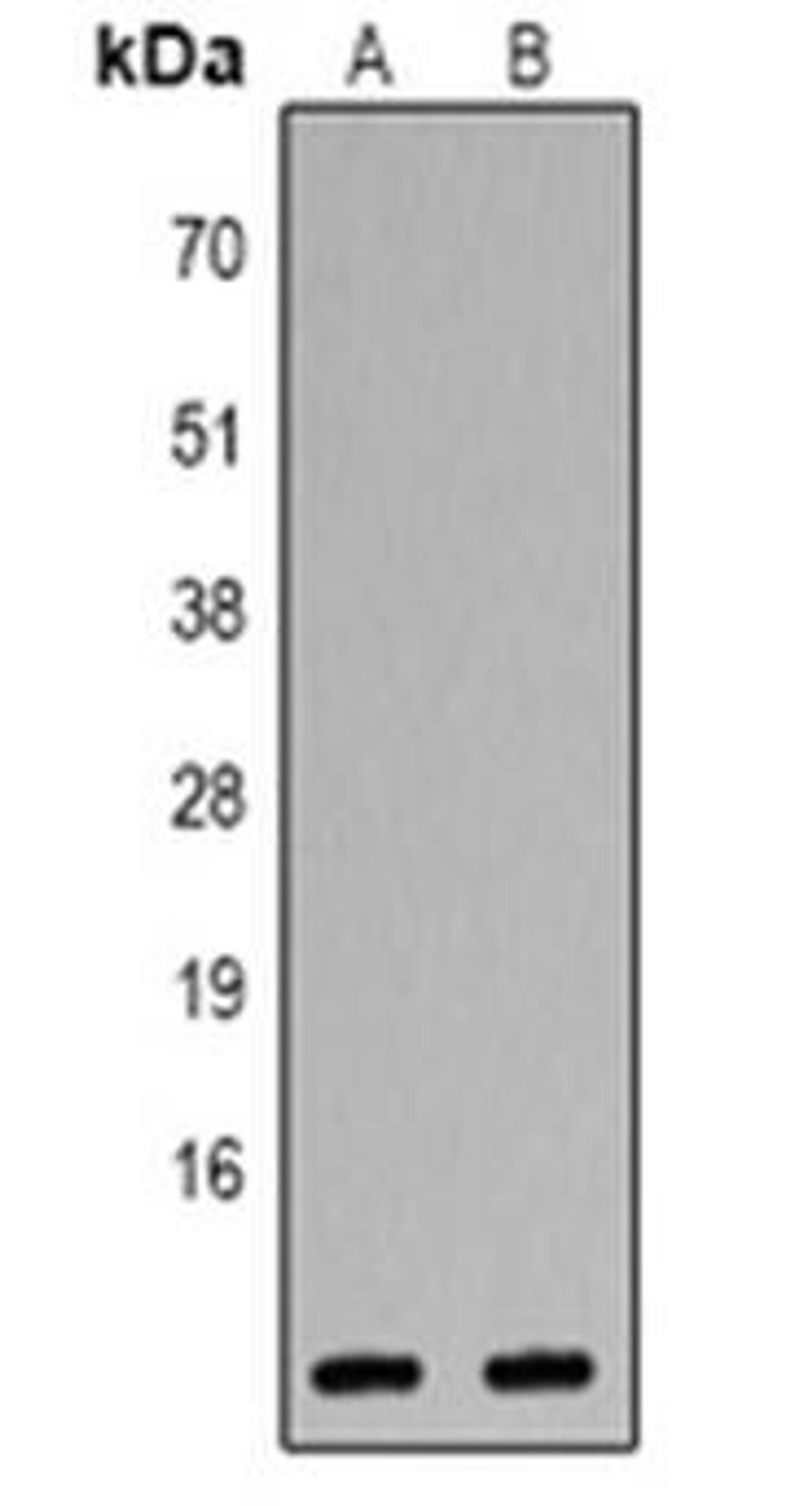 Western blot analysis of CXCL1 expression in Jurkat (Lane 1), Hela (Lane 2) whole cell lysates using CXCL1 antibody