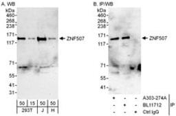 Detection of human ZNF507 by western blot and immunoprecipitation.