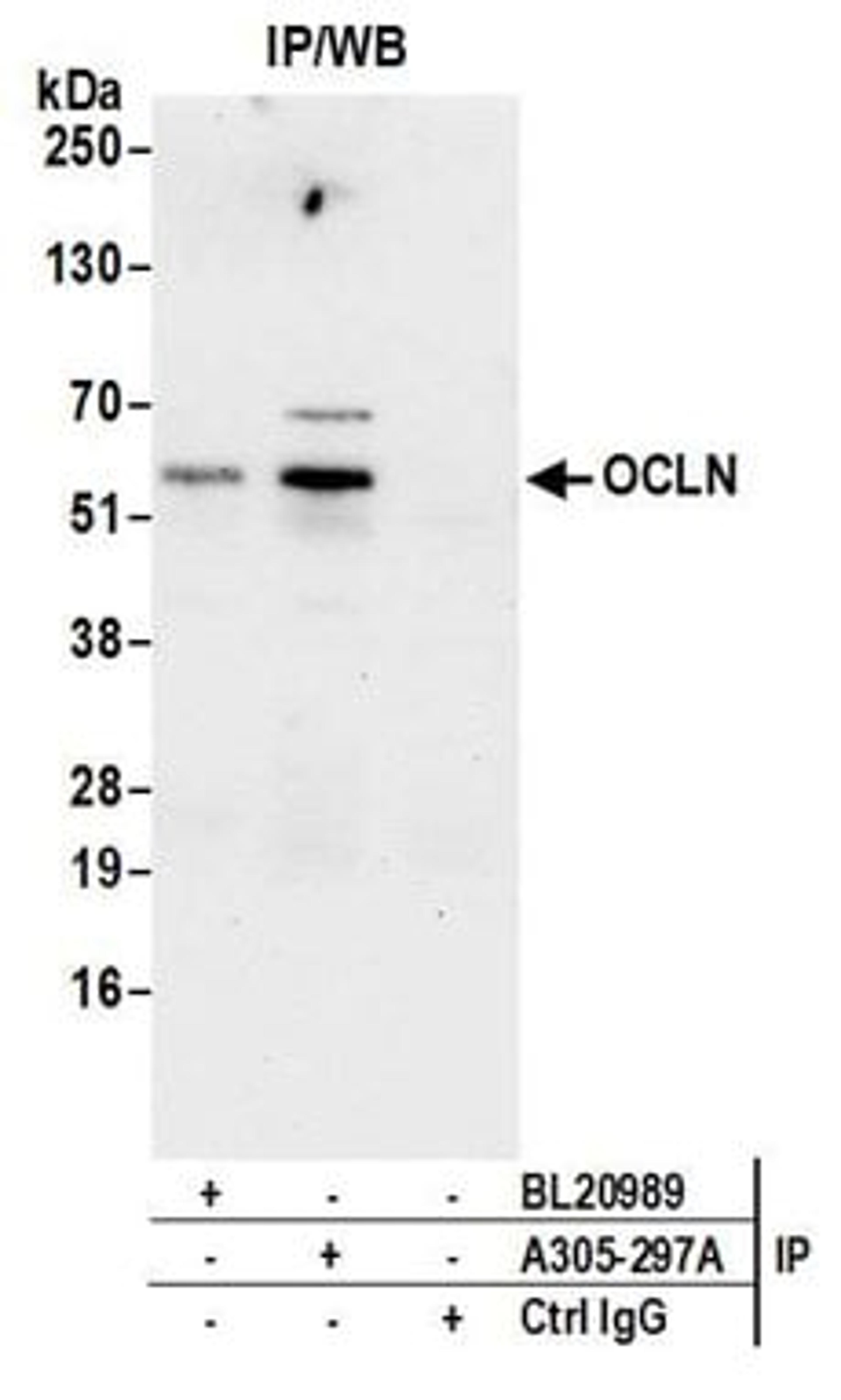 Detection of human Occludin by western blot of immunoprecipitates.