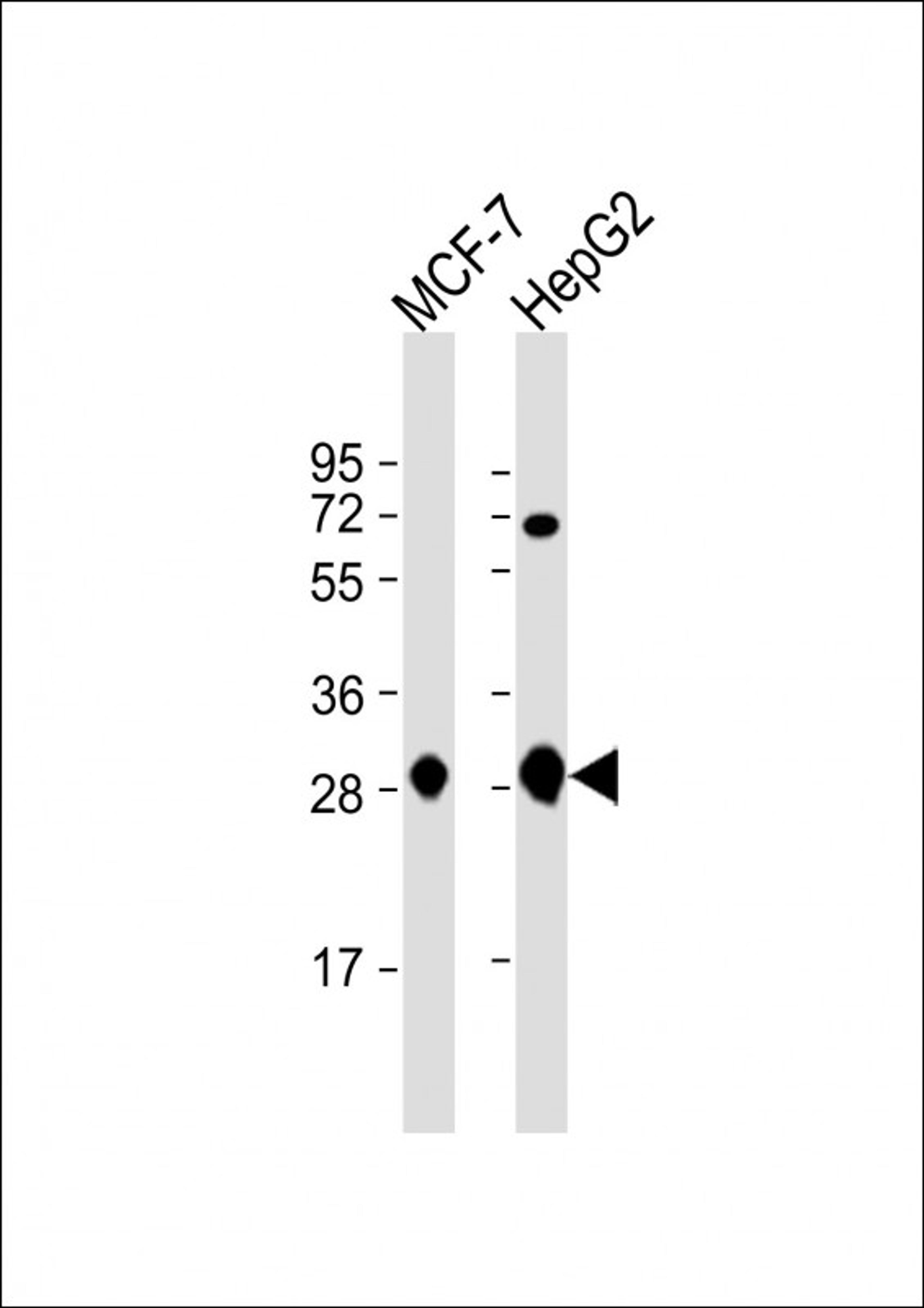 Western Blot at 1:1000 dilution Lane 1: MCF-7 whole cell lysate Lane 2: HepG2 whole cell lysate Lysates/proteins at 20 ug per lane.